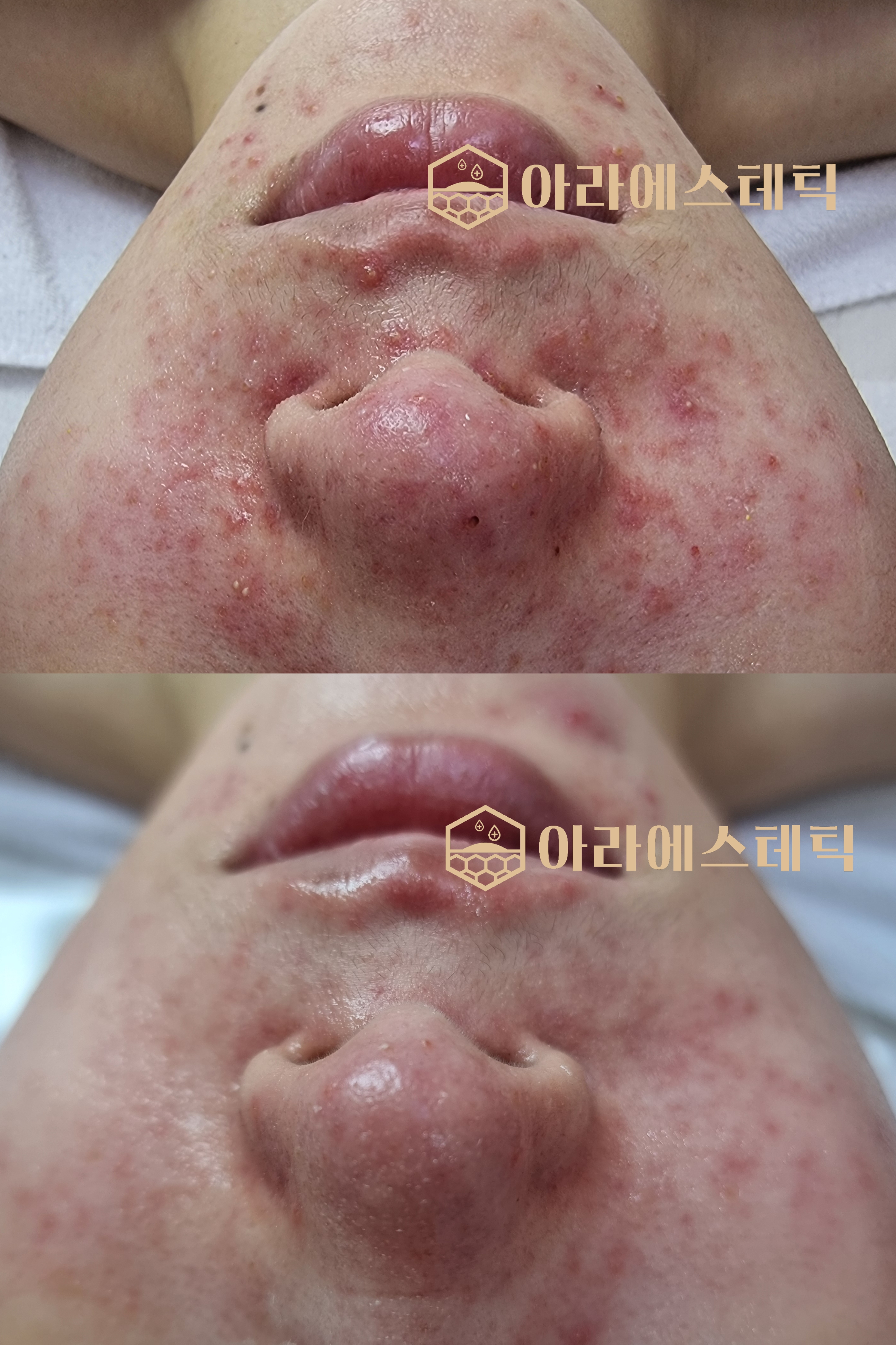 아라에스테틱 상모점 대표 이미지