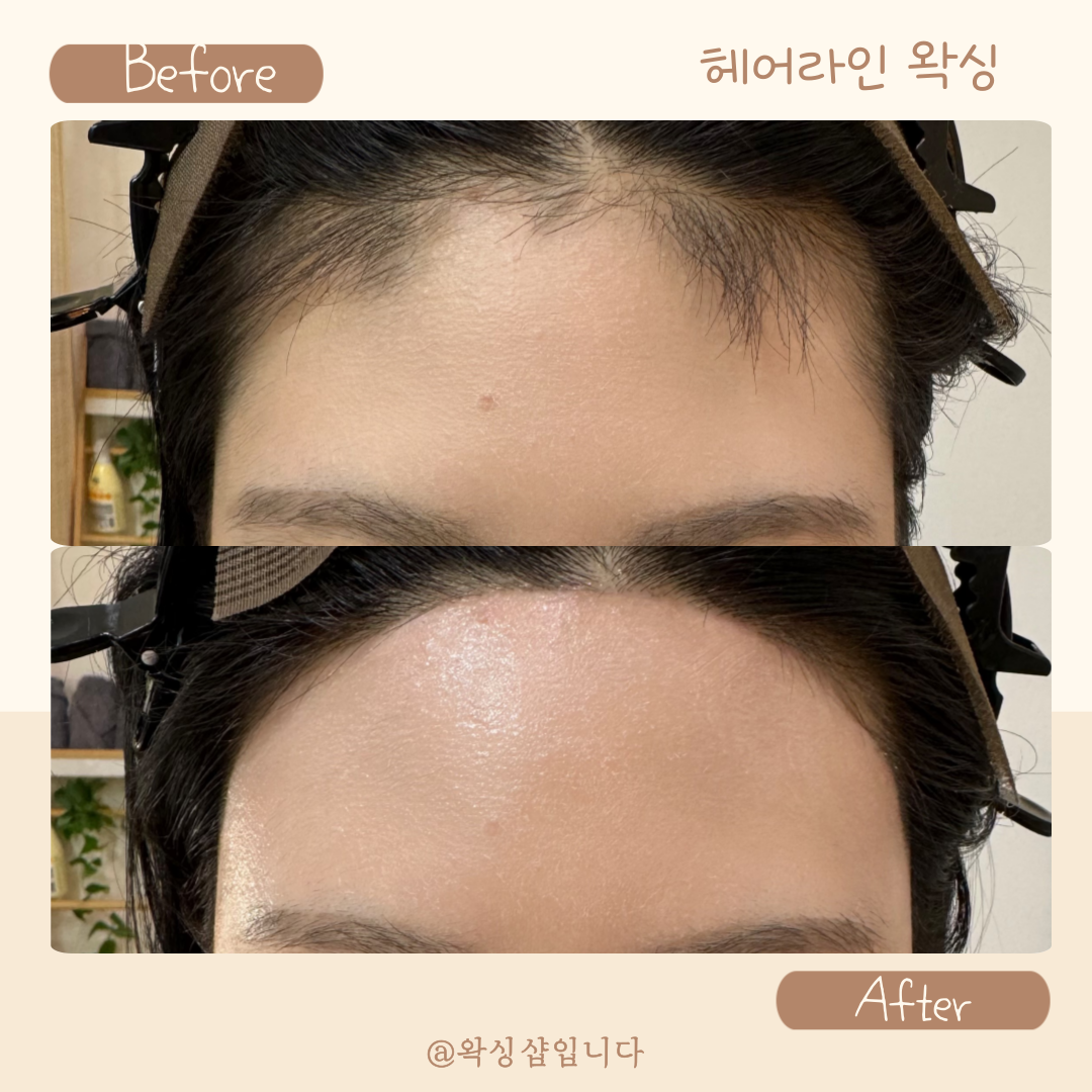 왁싱샵입니다 대표 이미지