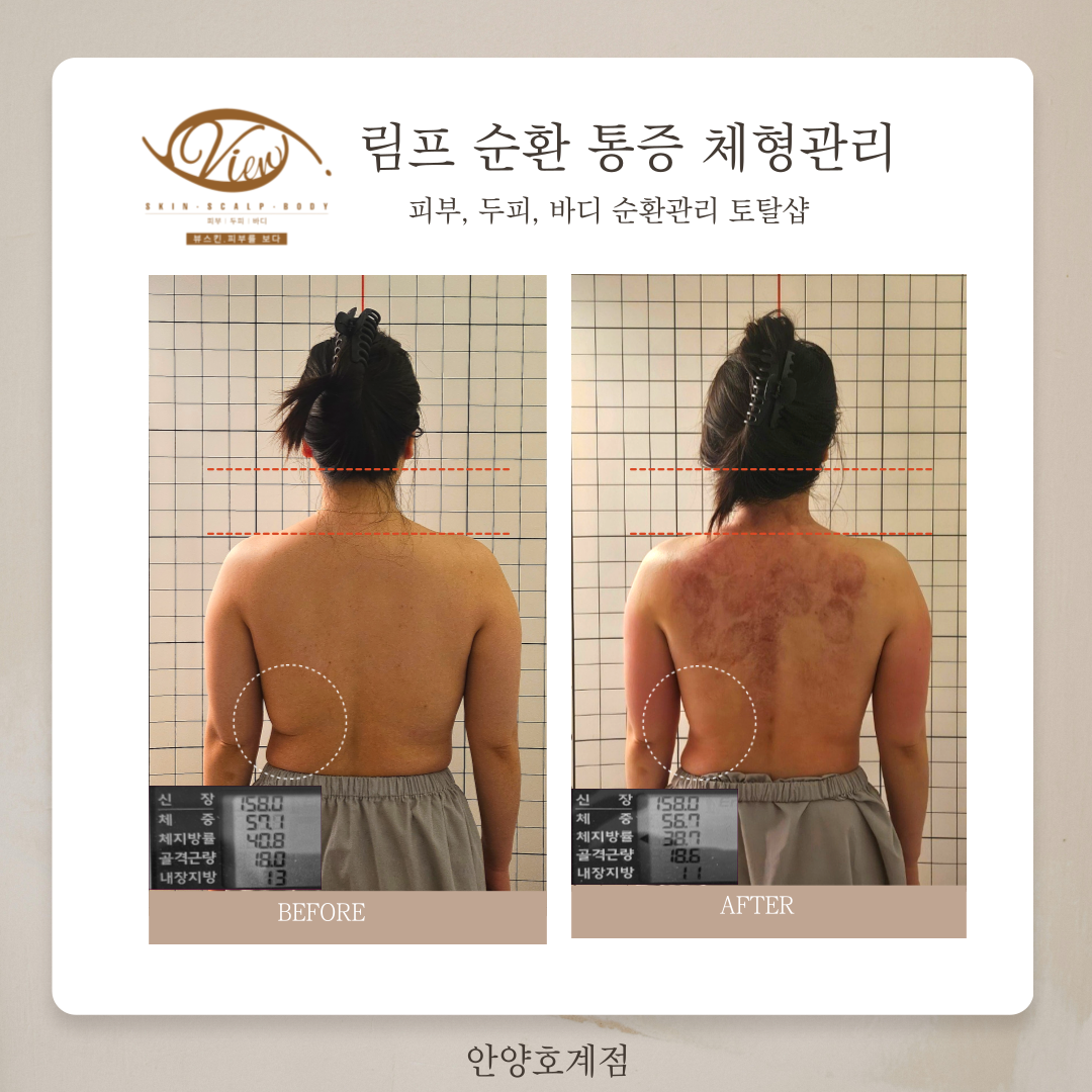 뷰스킨&숲칼프 안양호계점