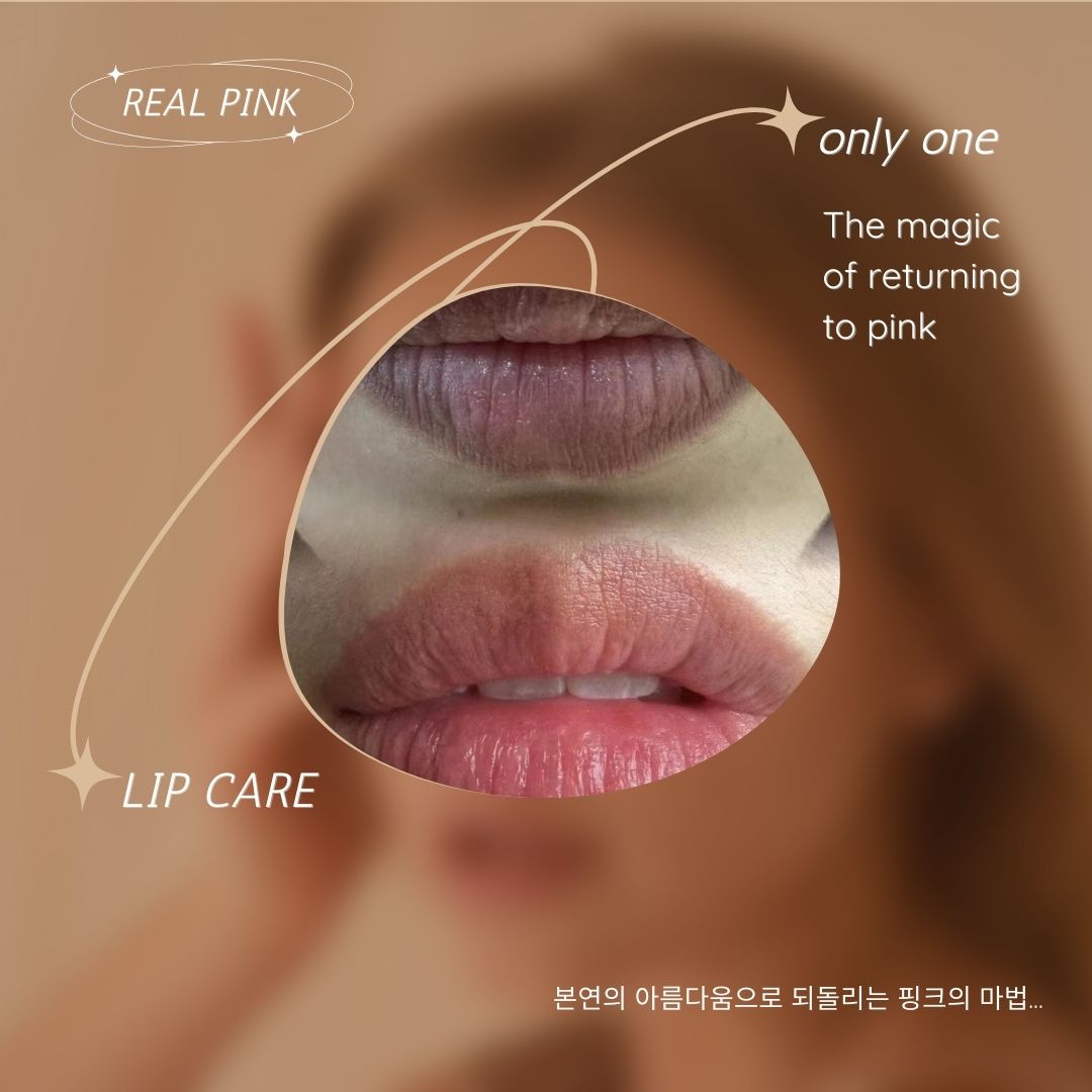 레드아이
