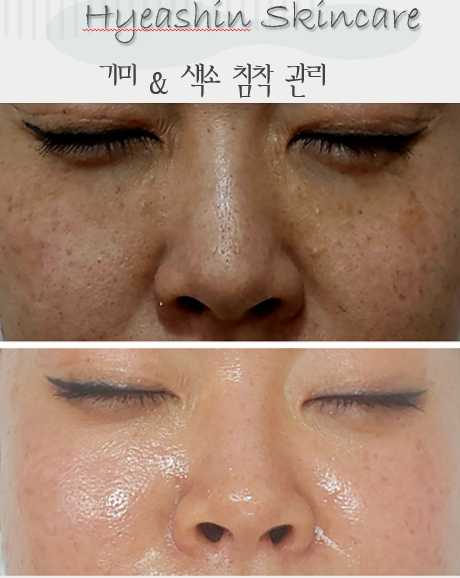 해신스킨케어 대표 이미지
