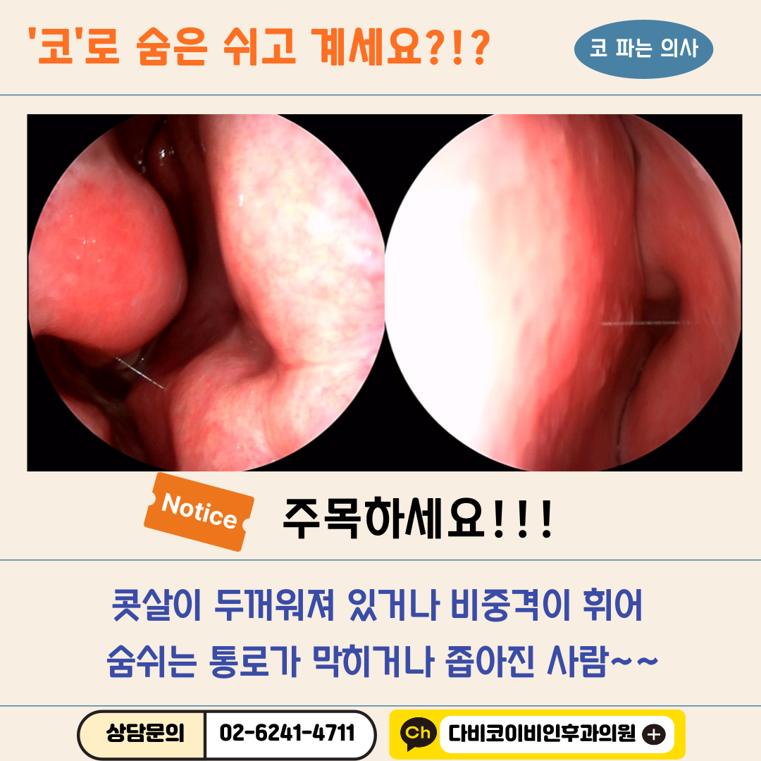 다비코이비인후과의원 대표 이미지