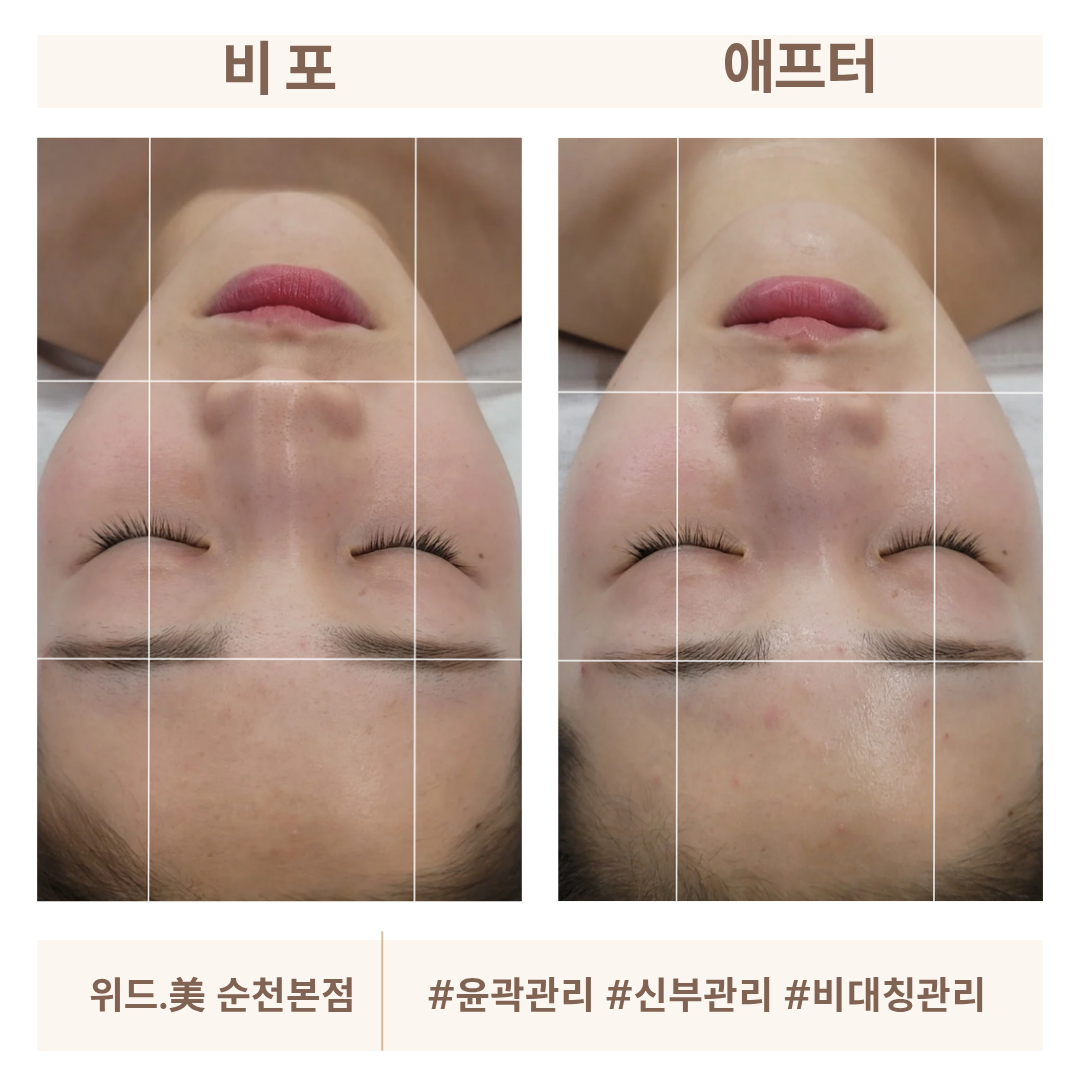 위드미 순천본점