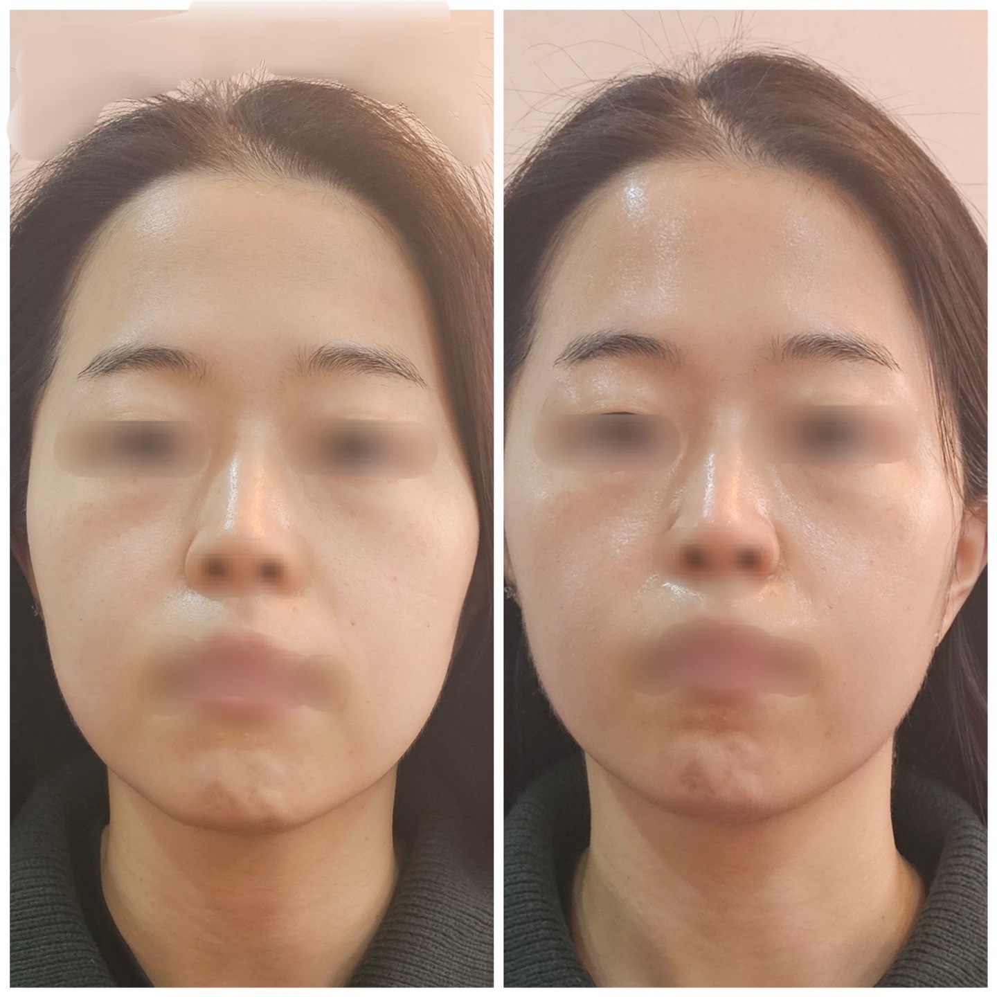 아모르테크뷰티 photo 9