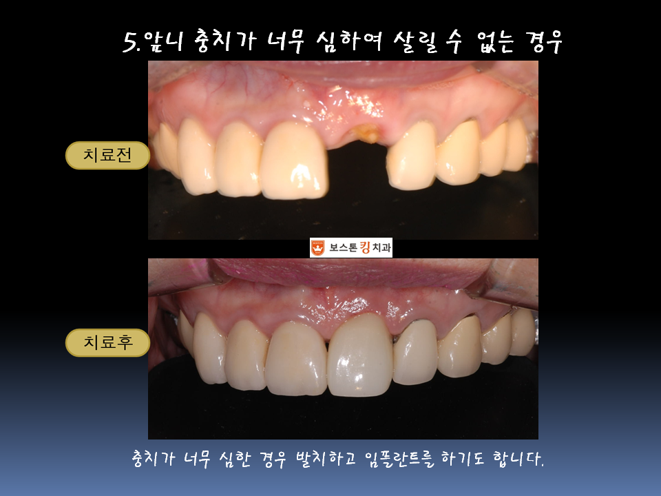 보스톤킹치과의원 대표 이미지