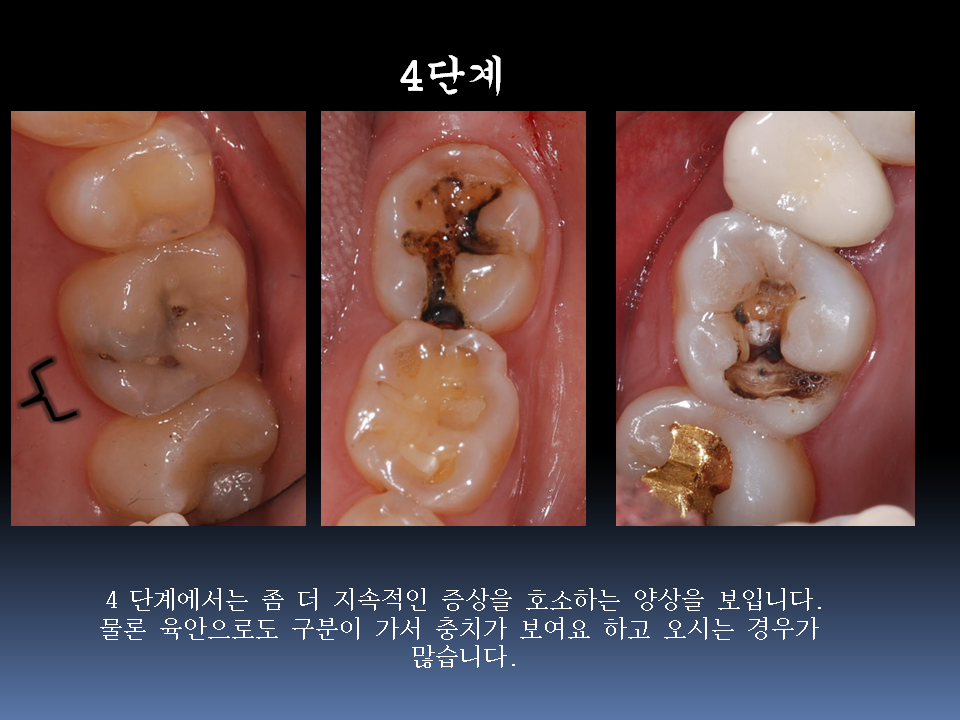 보스톤킹치과의원 대표 이미지
