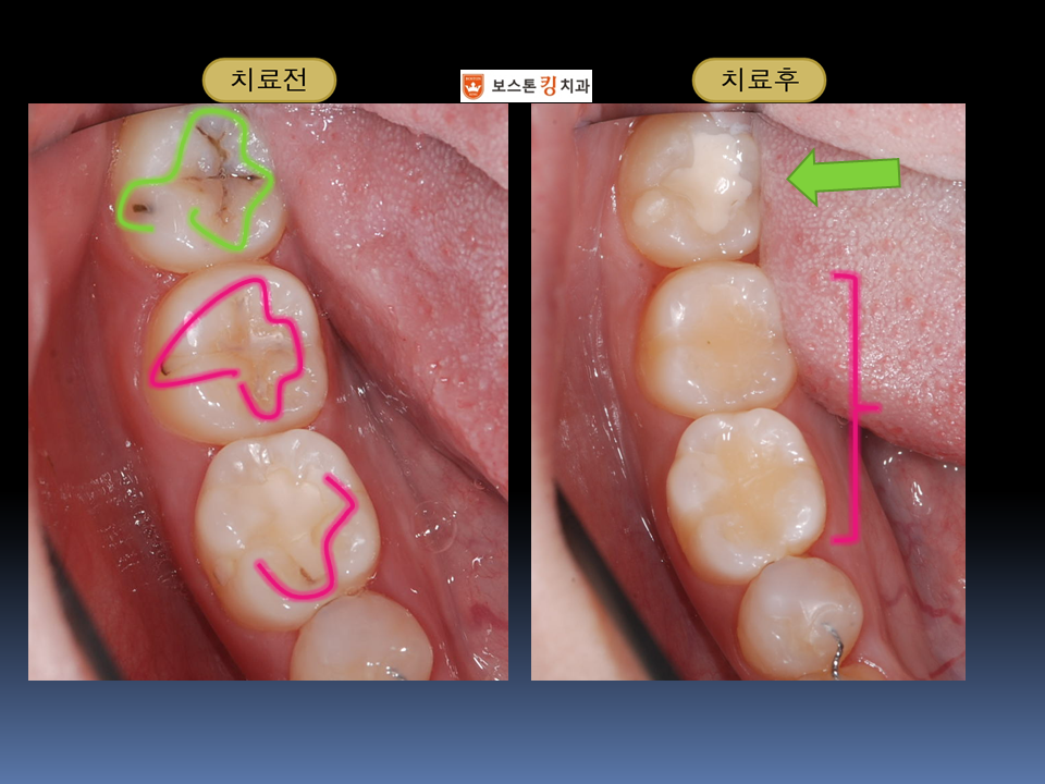 보스톤킹치과의원 대표 이미지