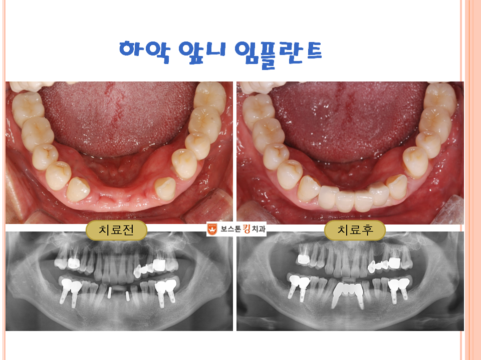 보스톤킹치과의원 대표 이미지