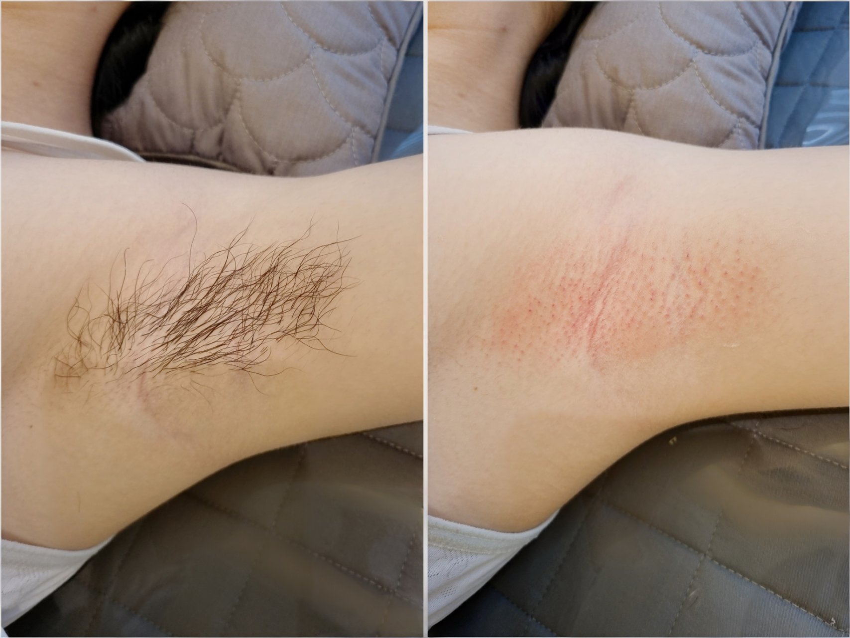아름에스테틱 대표 이미지