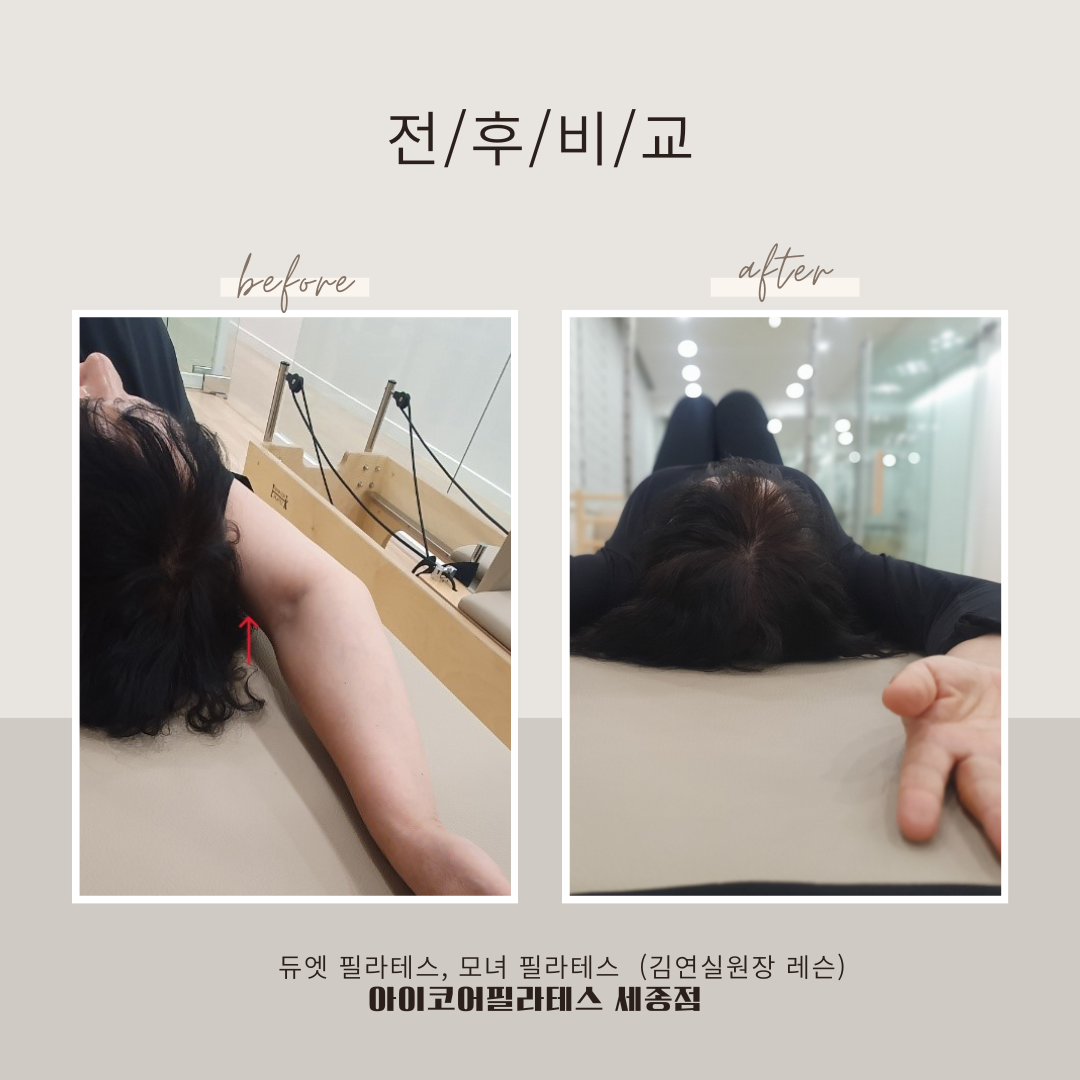 아이코어필라테스 세종점 대표 이미지