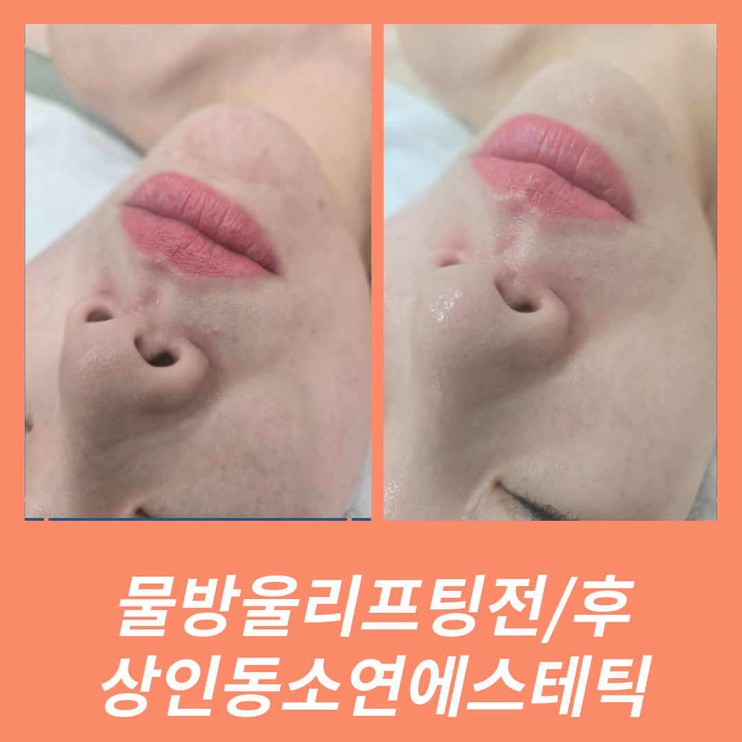 소연에스테틱 상인점