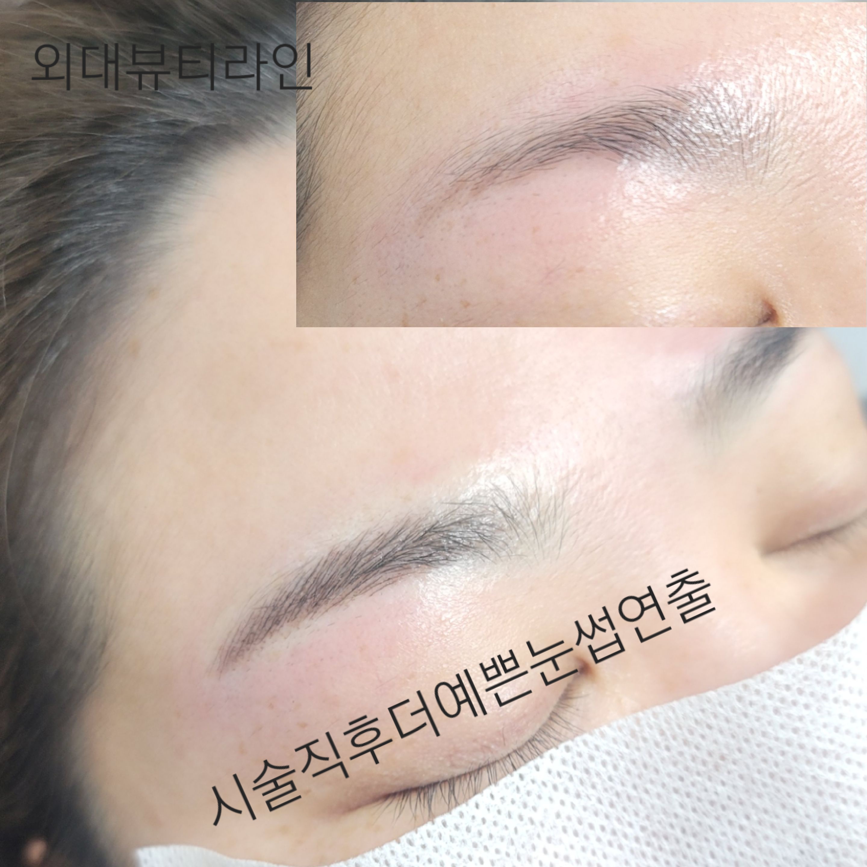 뷰티라인