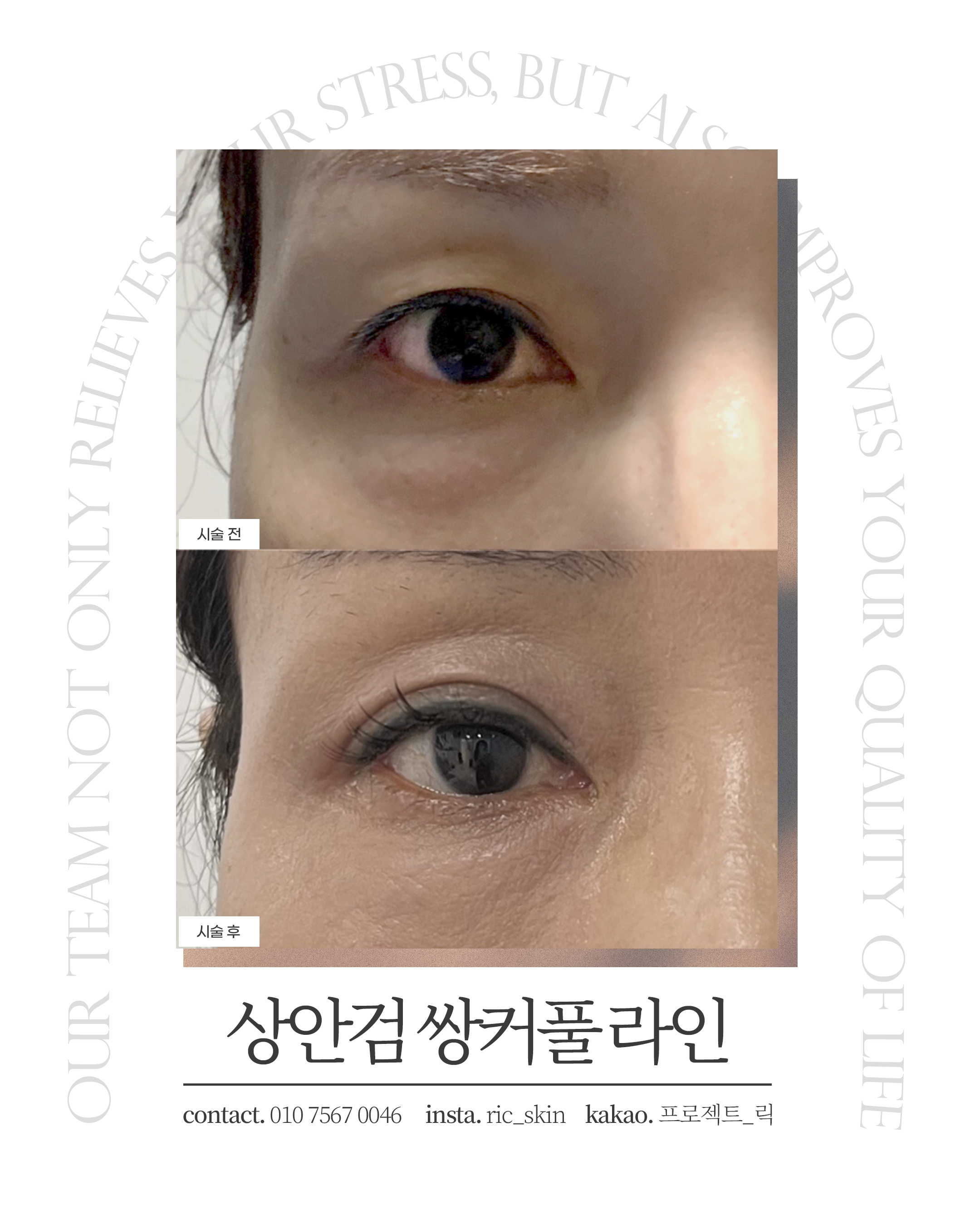 프로젝트 릭 대표 이미지