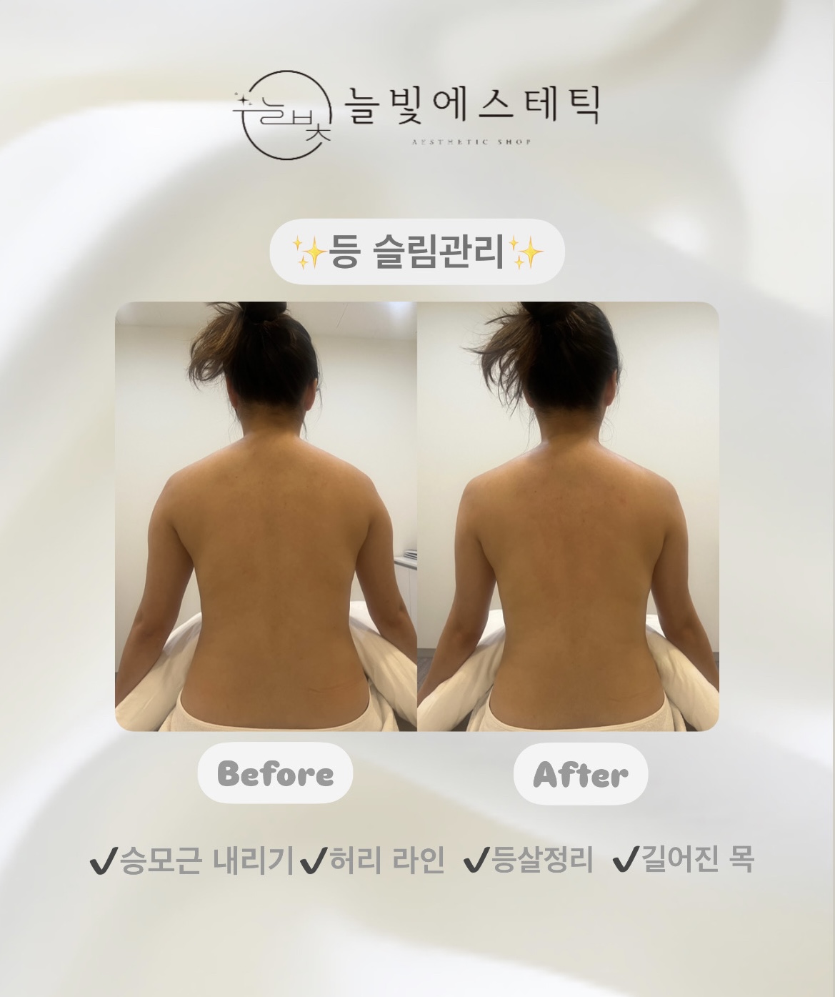 늘빛에스테틱