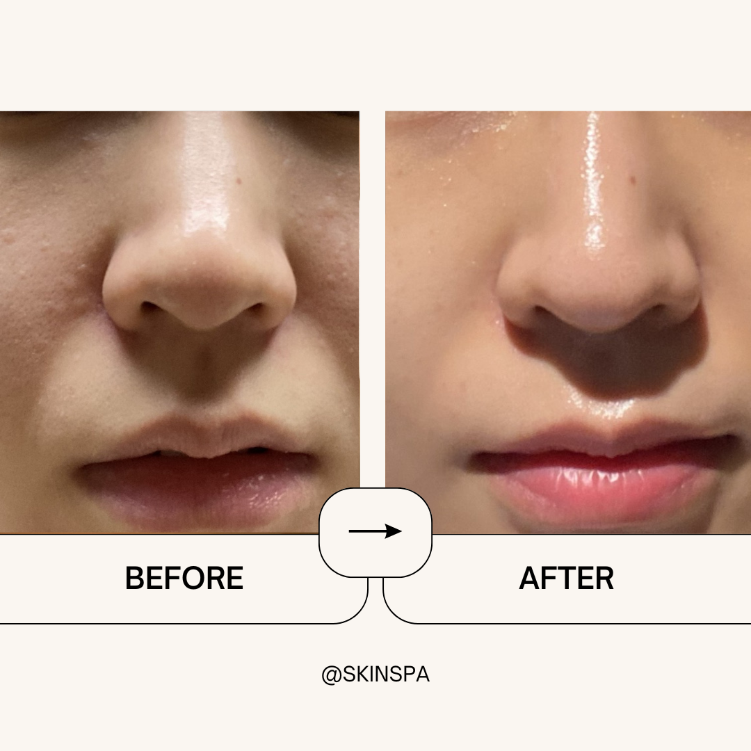 스킨스파 명동본점 대표 이미지