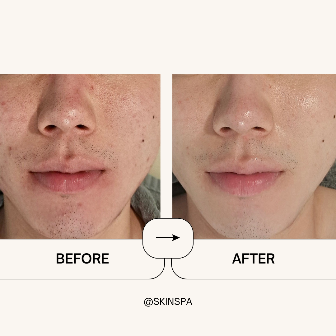 스킨스파 명동본점 대표 이미지