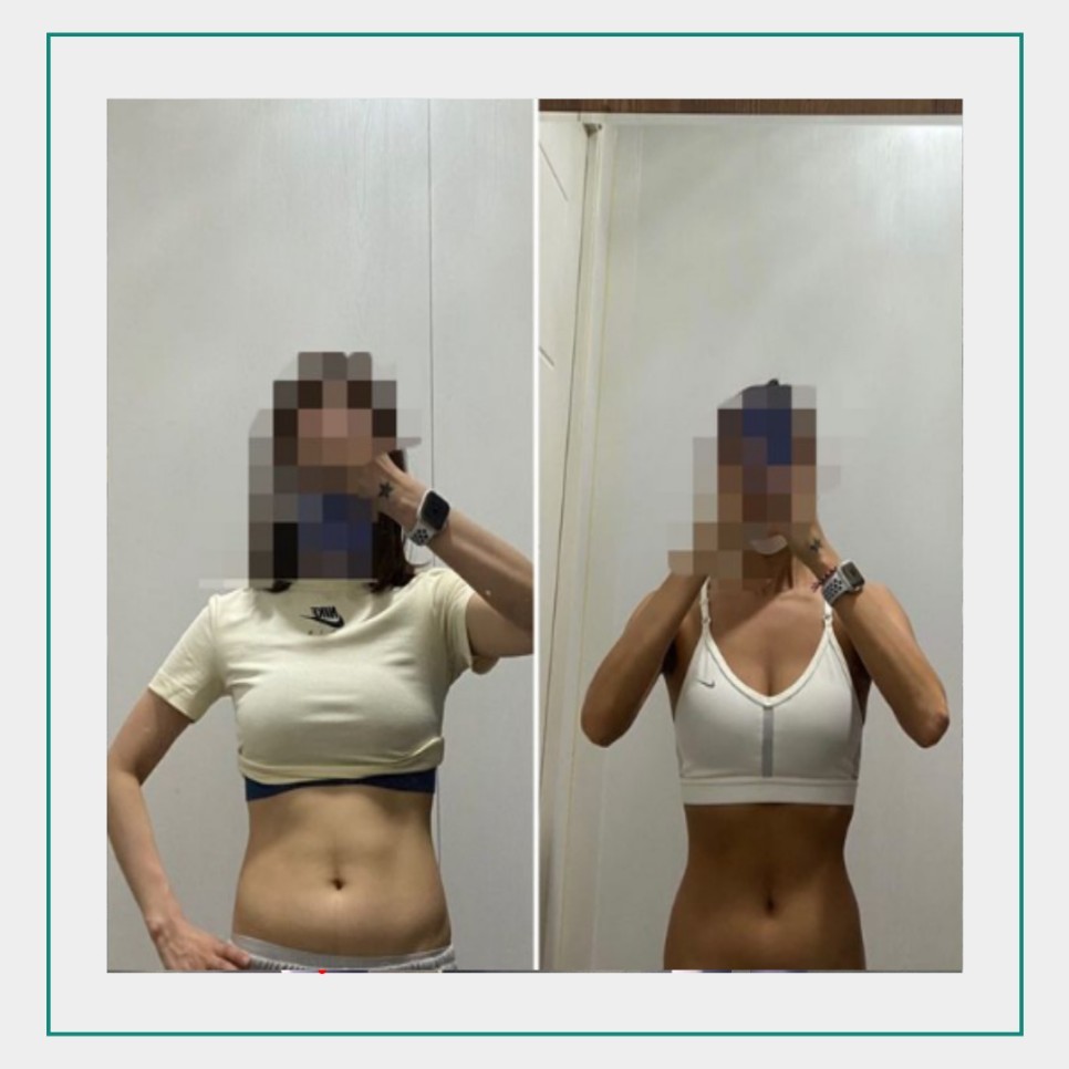 여성전용 포레스트짐 헬스&피티 주엽점