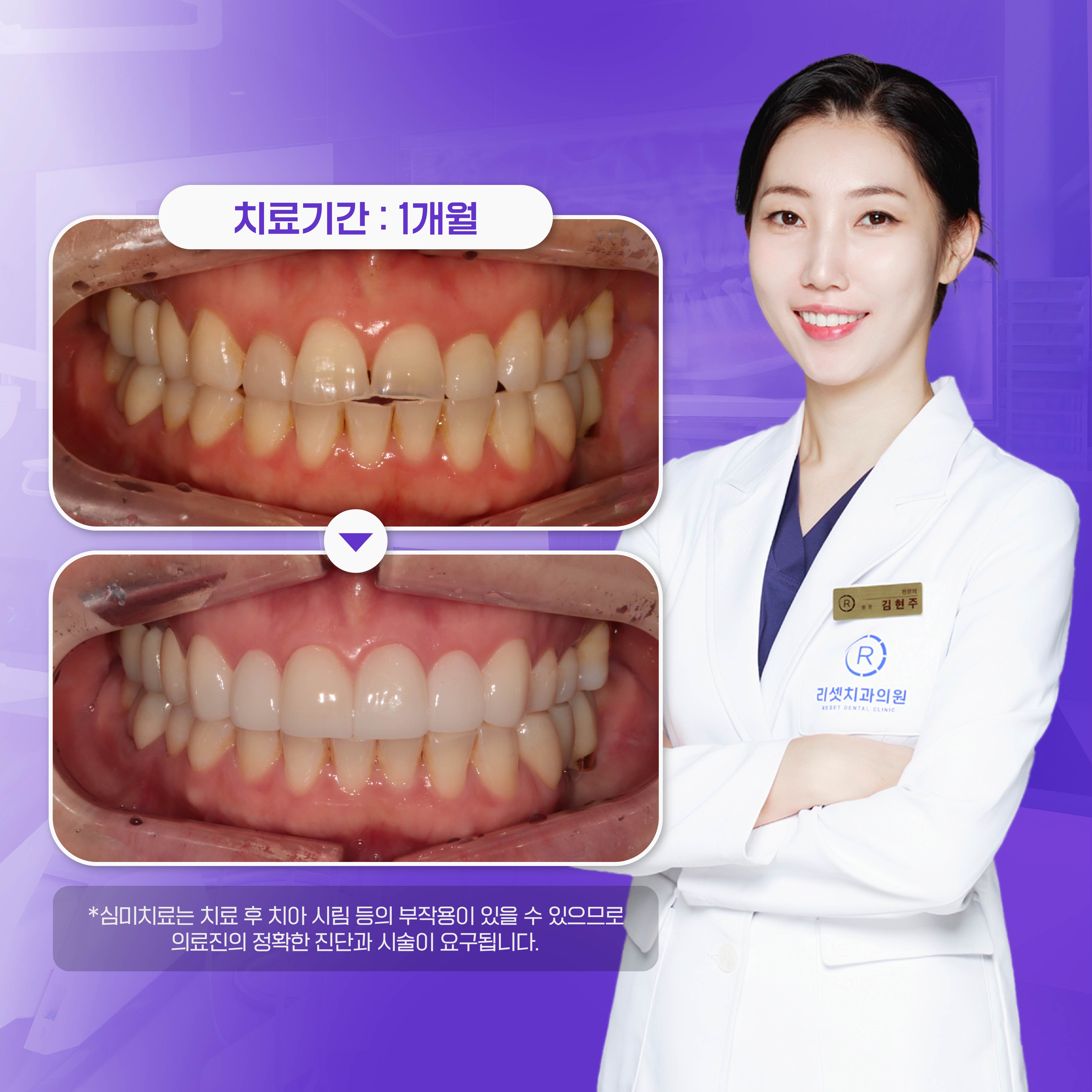 리셋치과의원 부산서면 대표 이미지