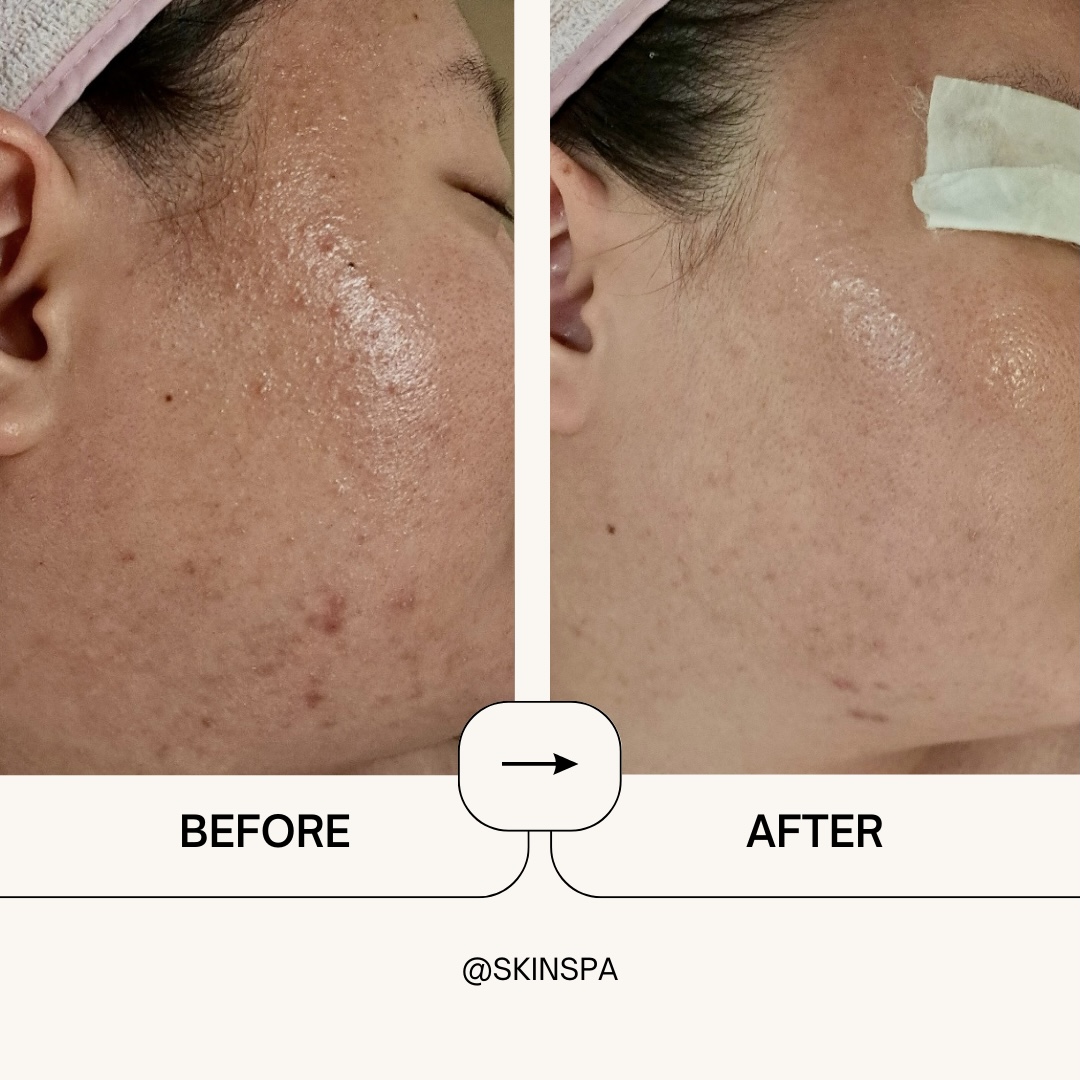 스킨스파 명동본점 대표 이미지