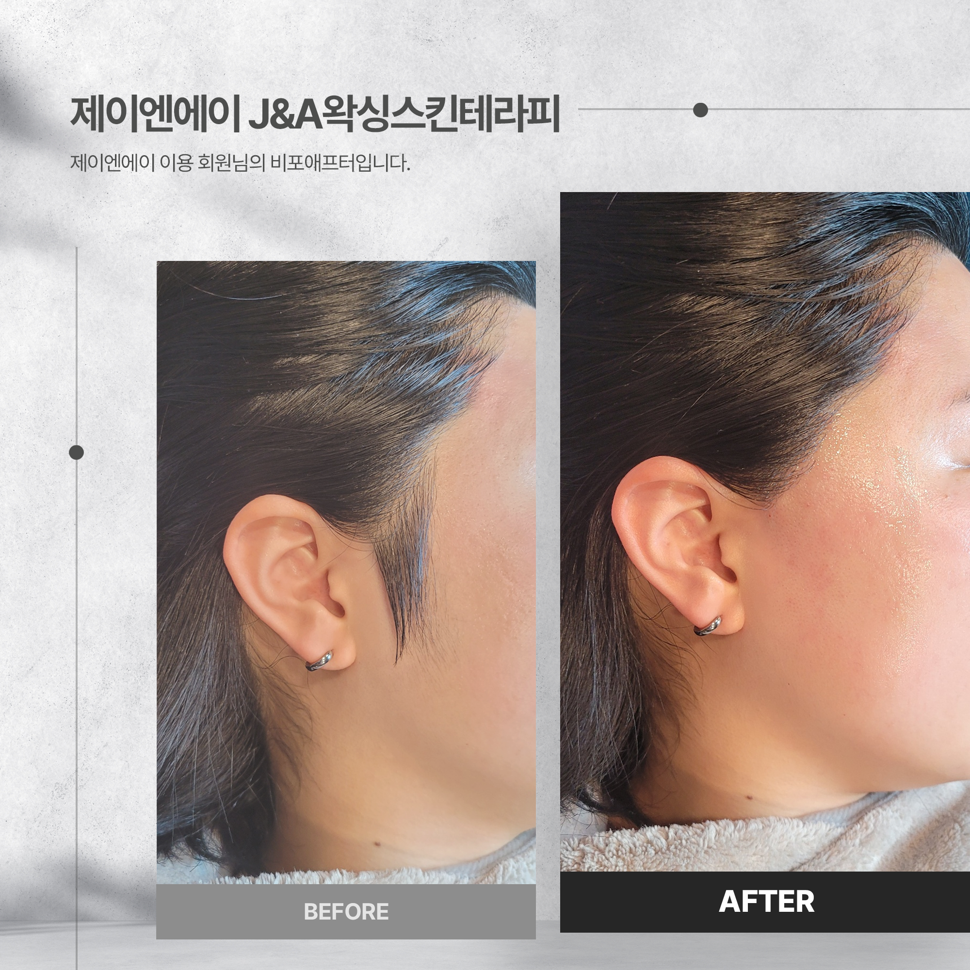 제이엔에이 왁싱 스킨 테라피