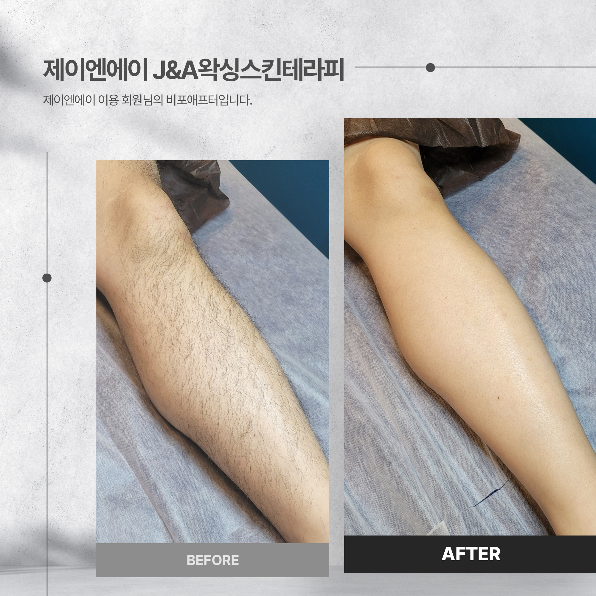제이엔에이 왁싱 스킨 테라피