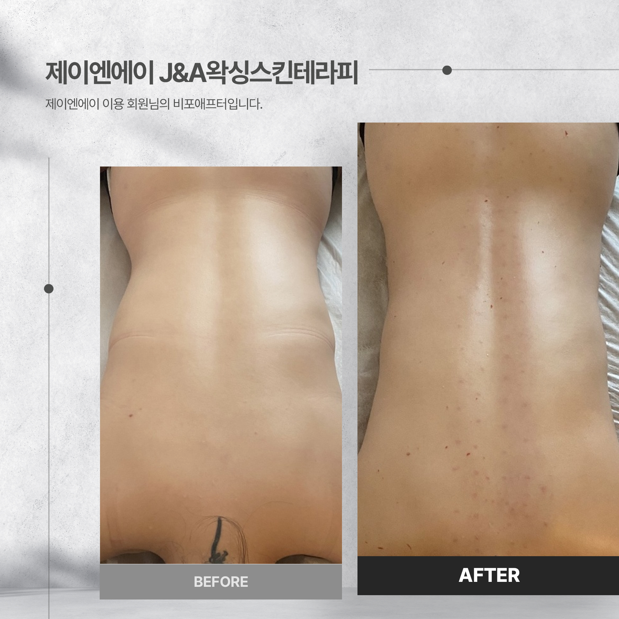 제이엔에이 왁싱 스킨 테라피