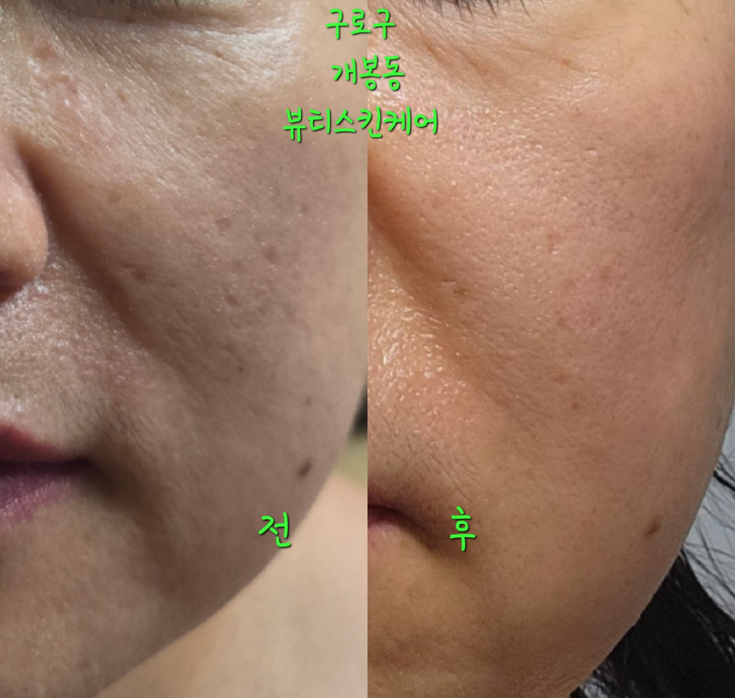 뷰티스킨케어 개봉동본점 대표 이미지