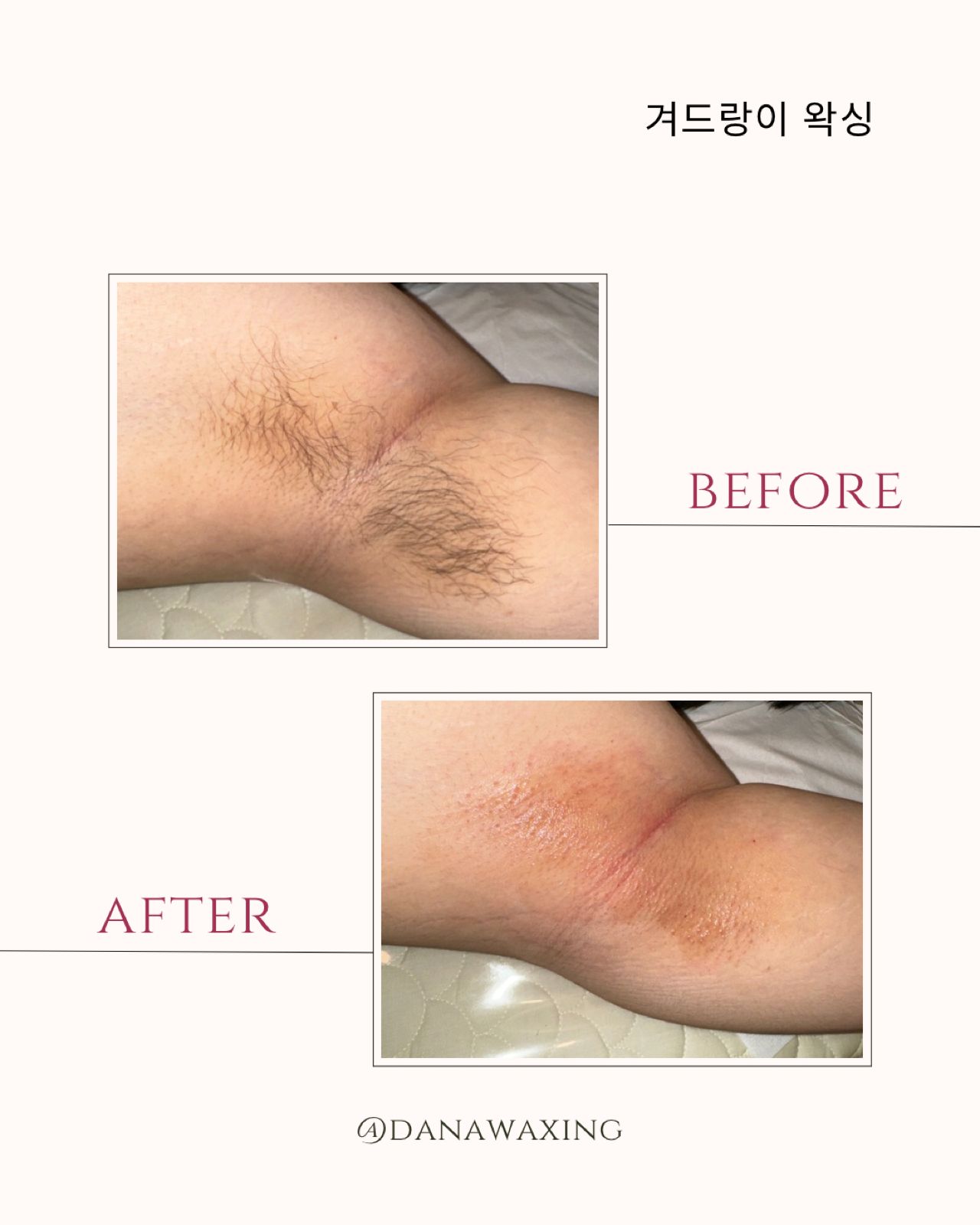 다나왁싱 대표 이미지