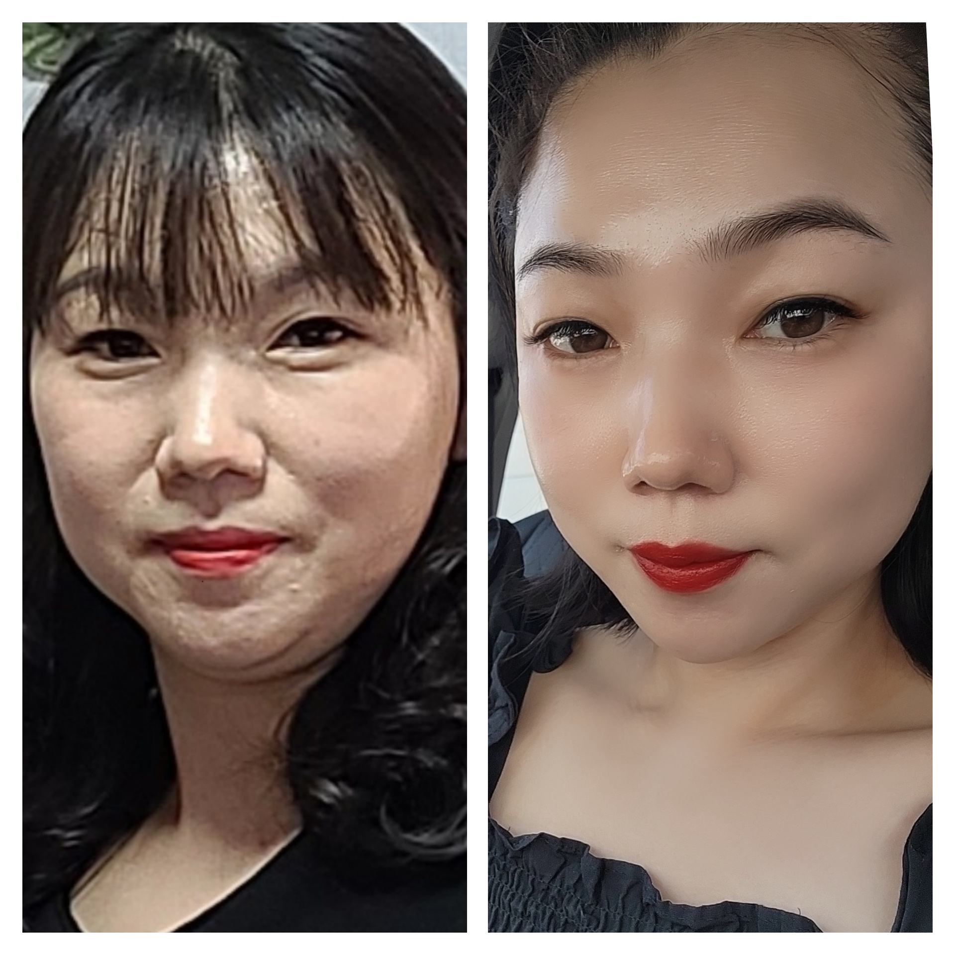 인셀덤 B&B 대전대리점