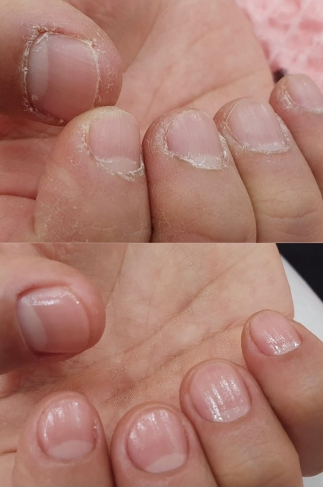 손발 다 가온나 대표 이미지