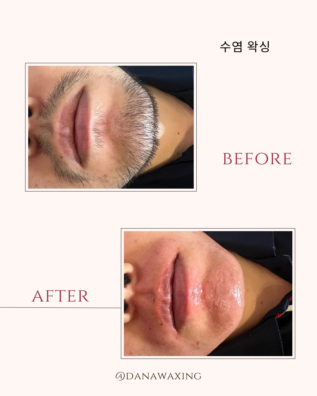 다나왁싱 대표 이미지
