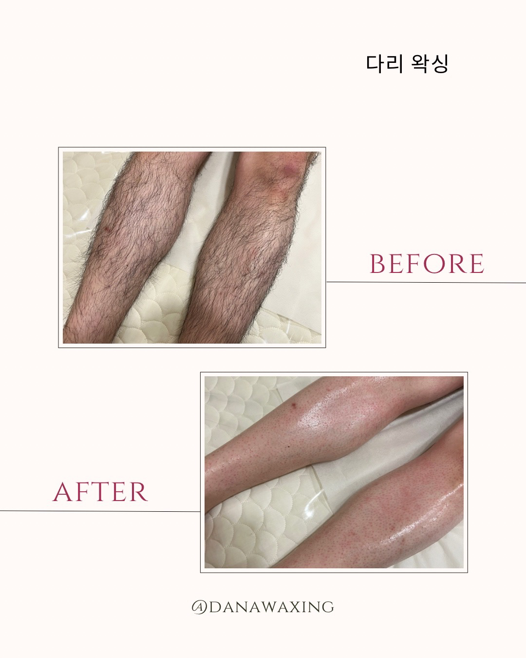 다나왁싱 대표 이미지