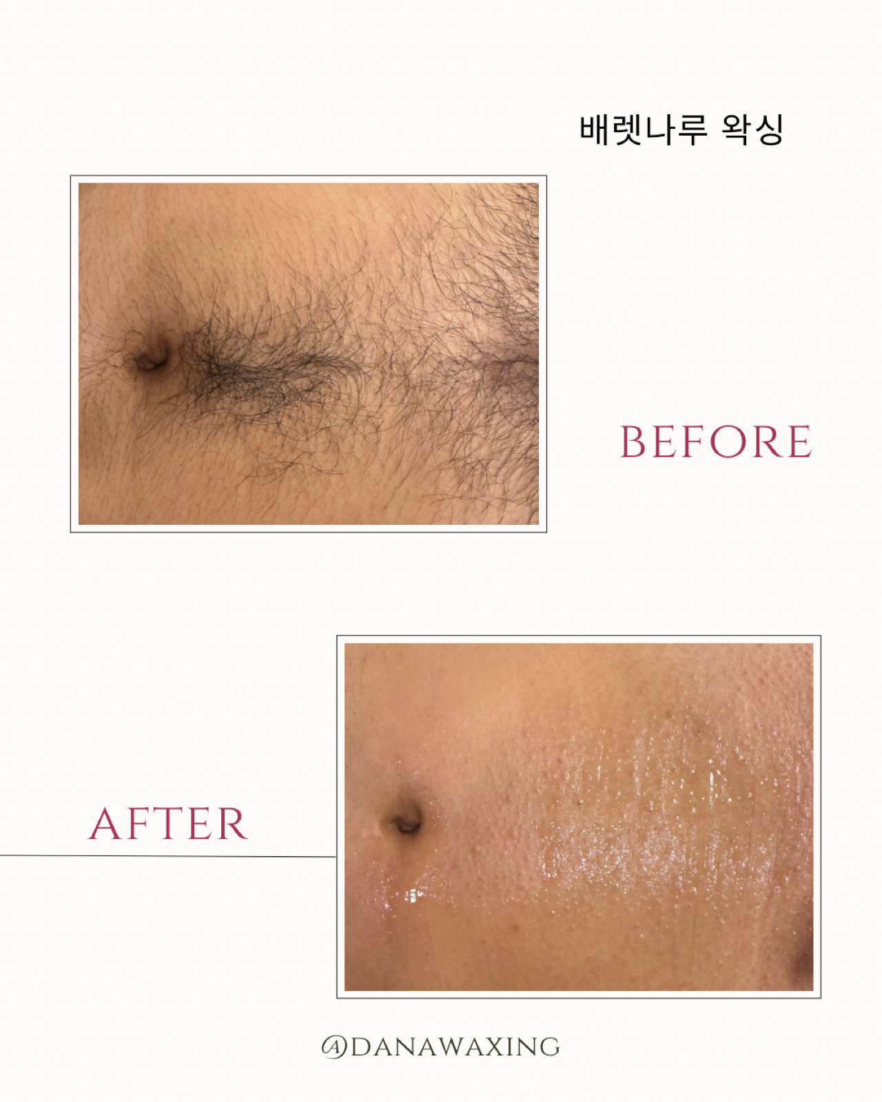 다나왁싱 대표 이미지