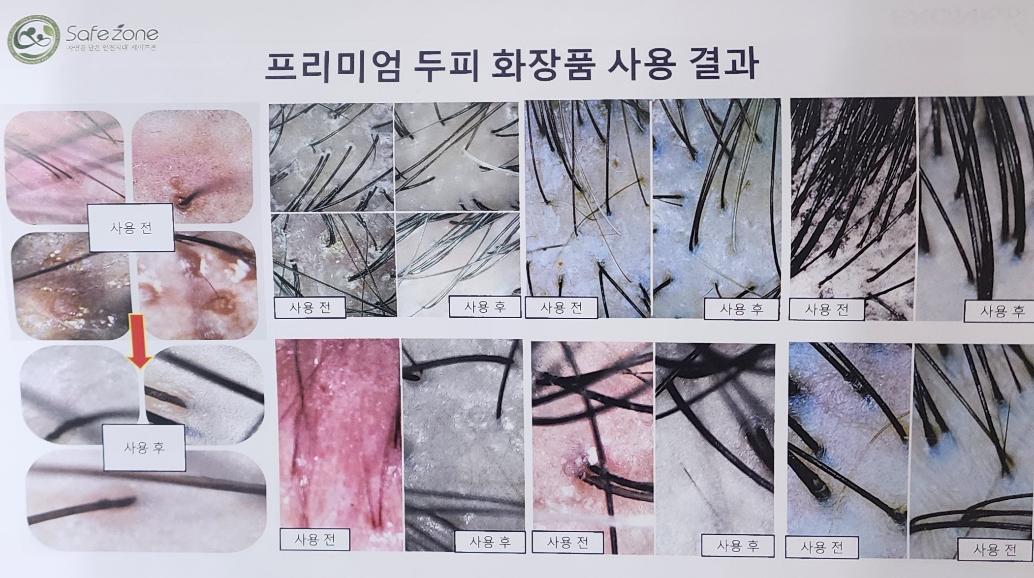 세이프존