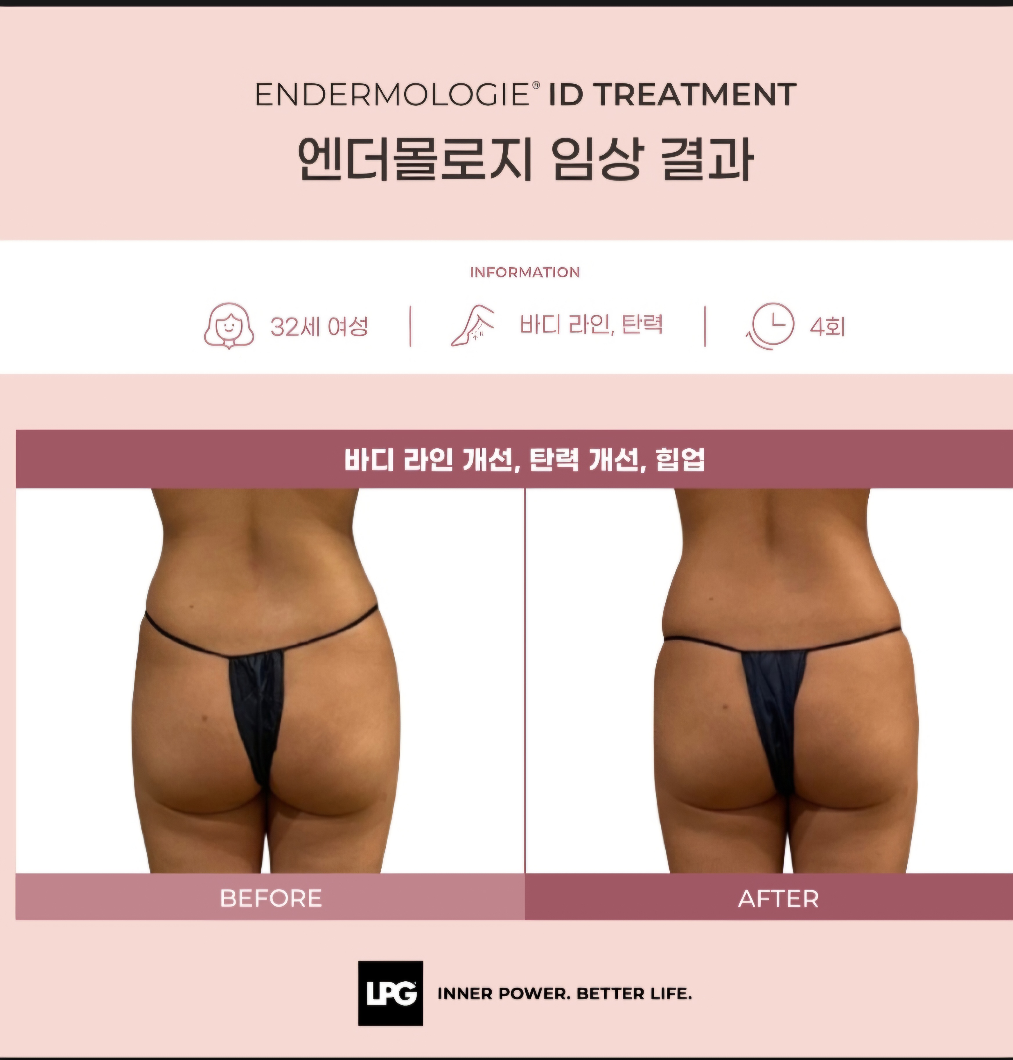 비타C스킨갤러리