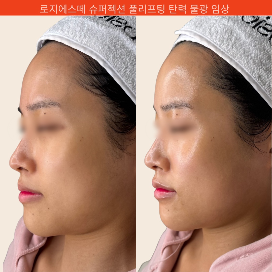 로지에스떼 서초 잠원본점 대표 이미지