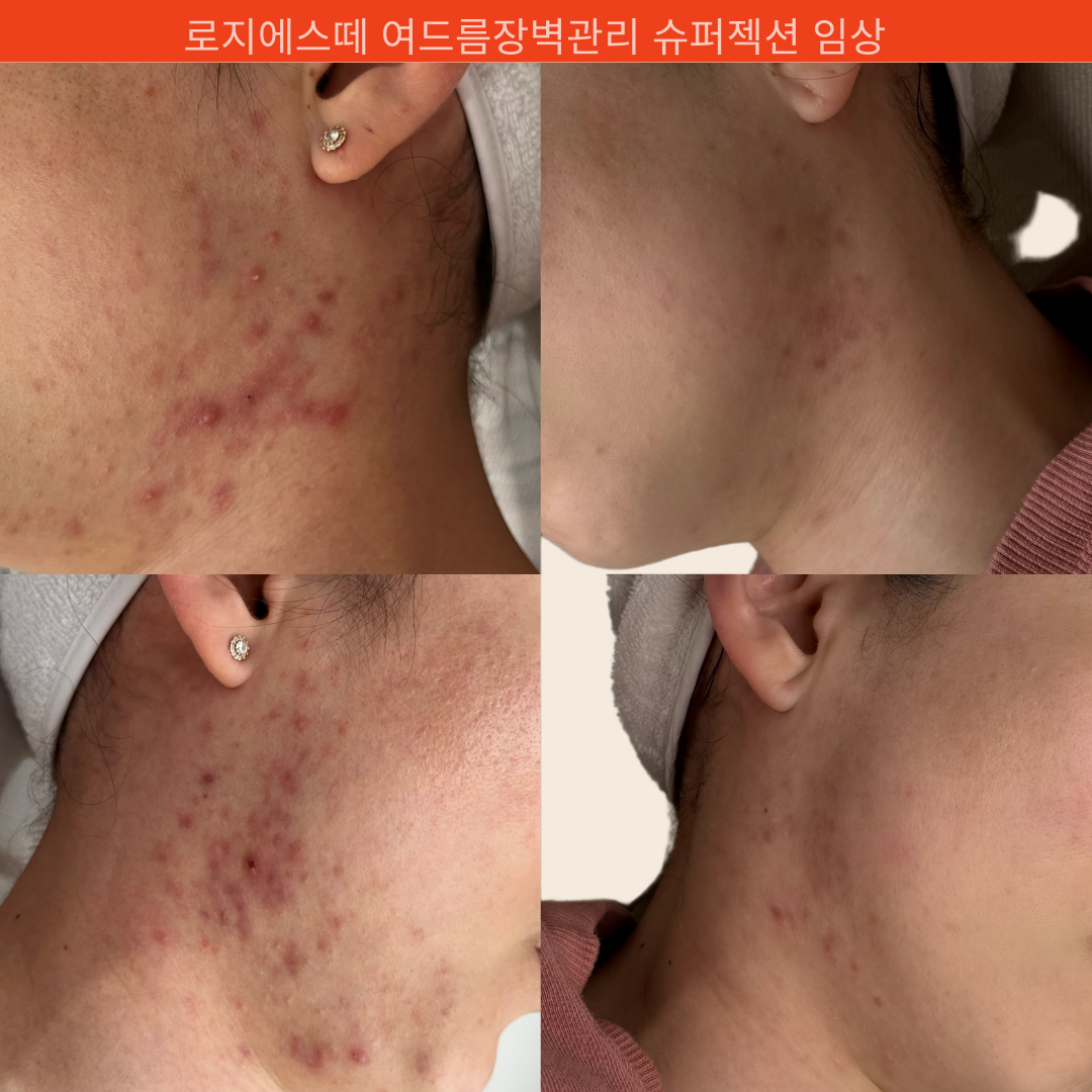 로지에스떼 서초 잠원본점 대표 이미지