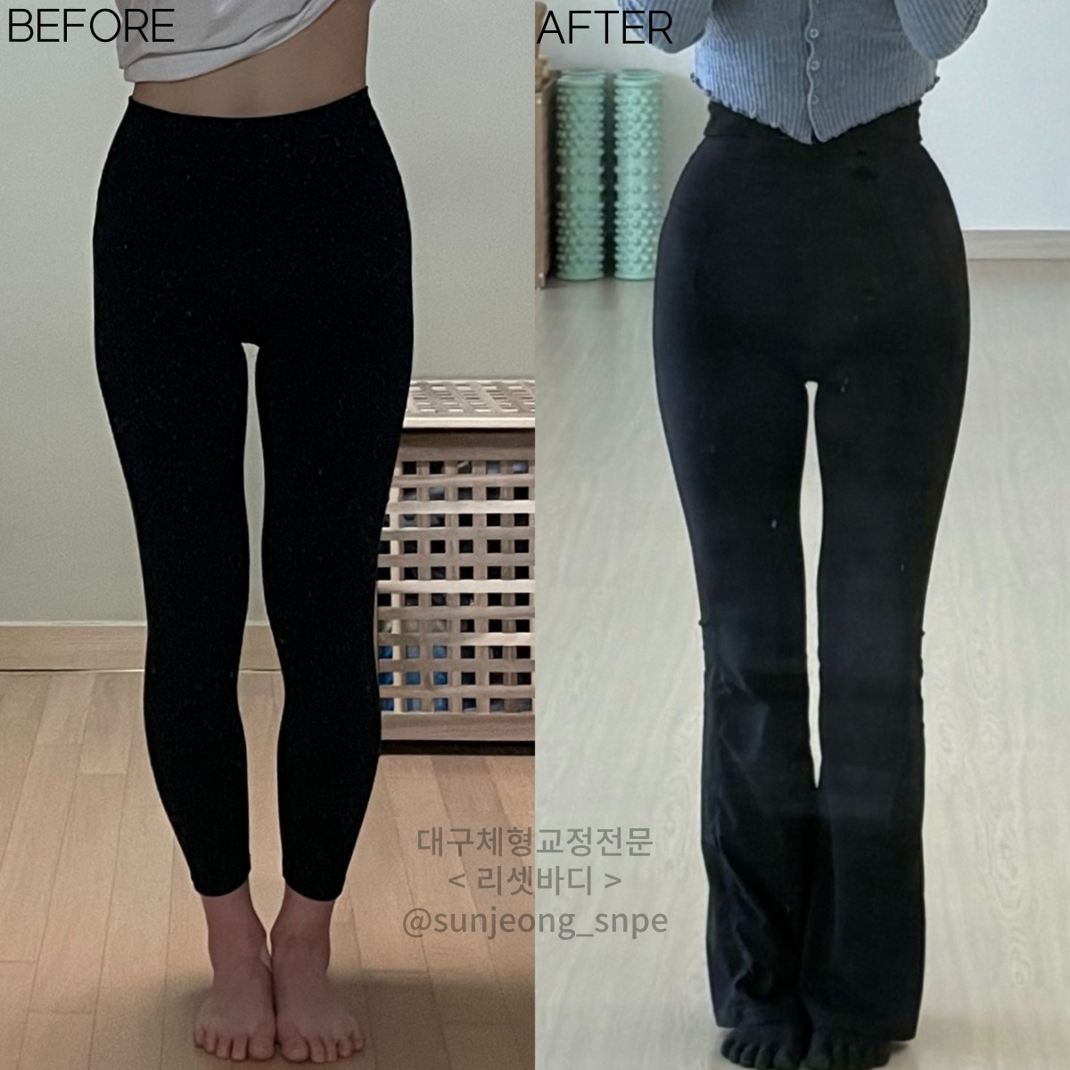 리셋바디