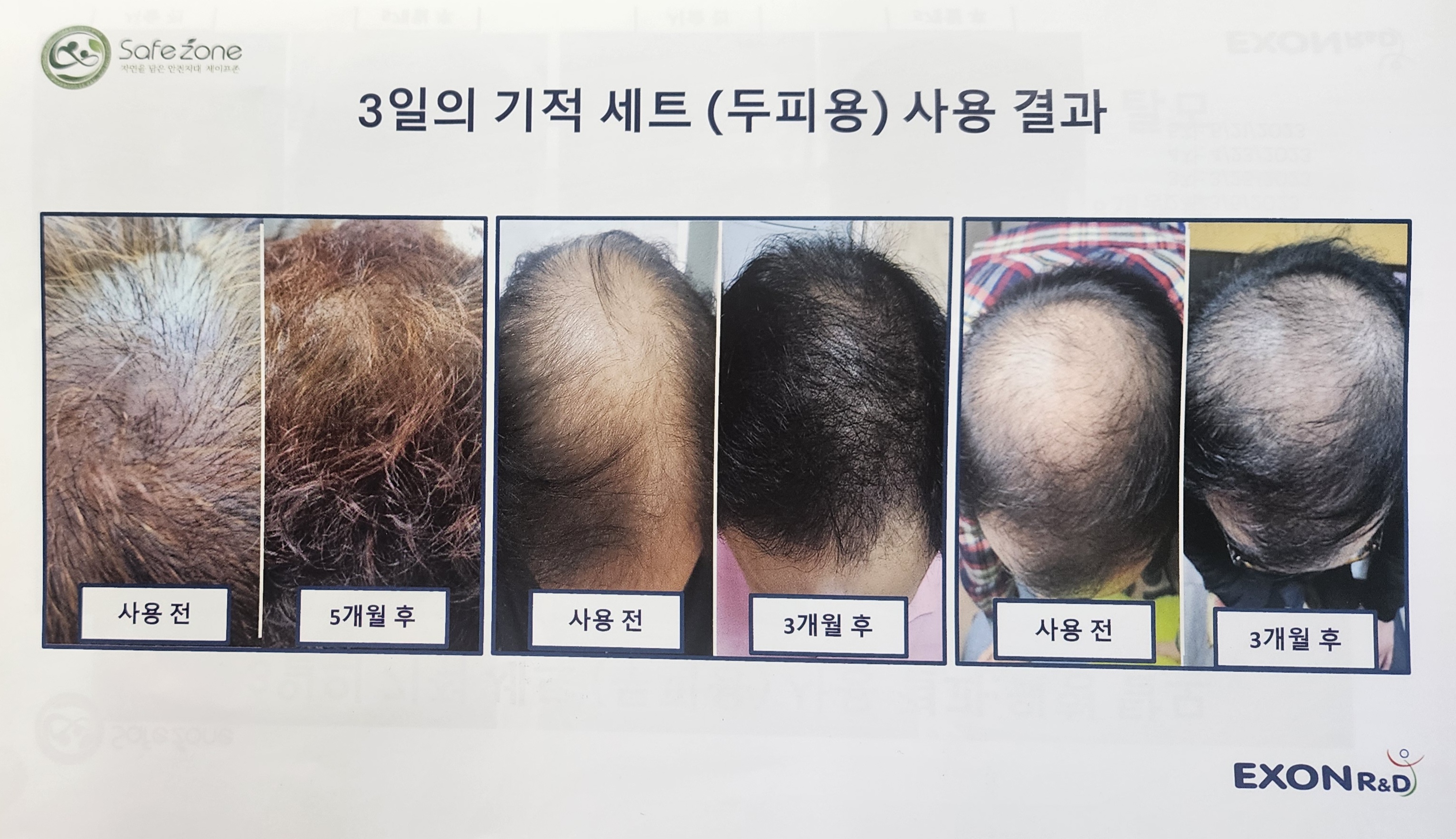 세이프존