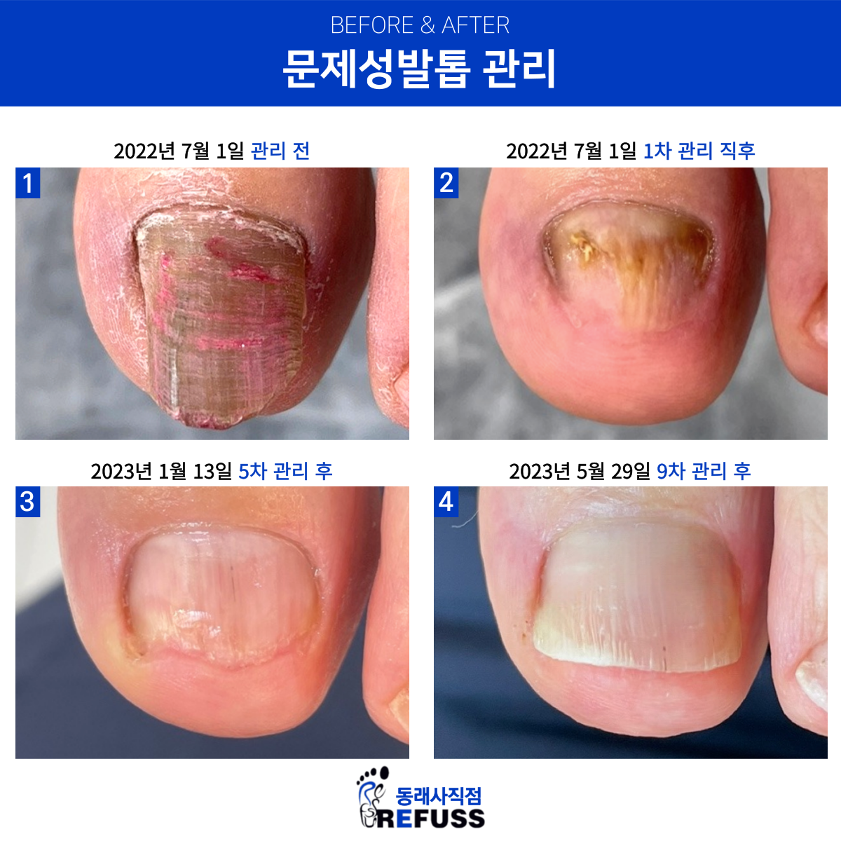 레푸스 동래사직점