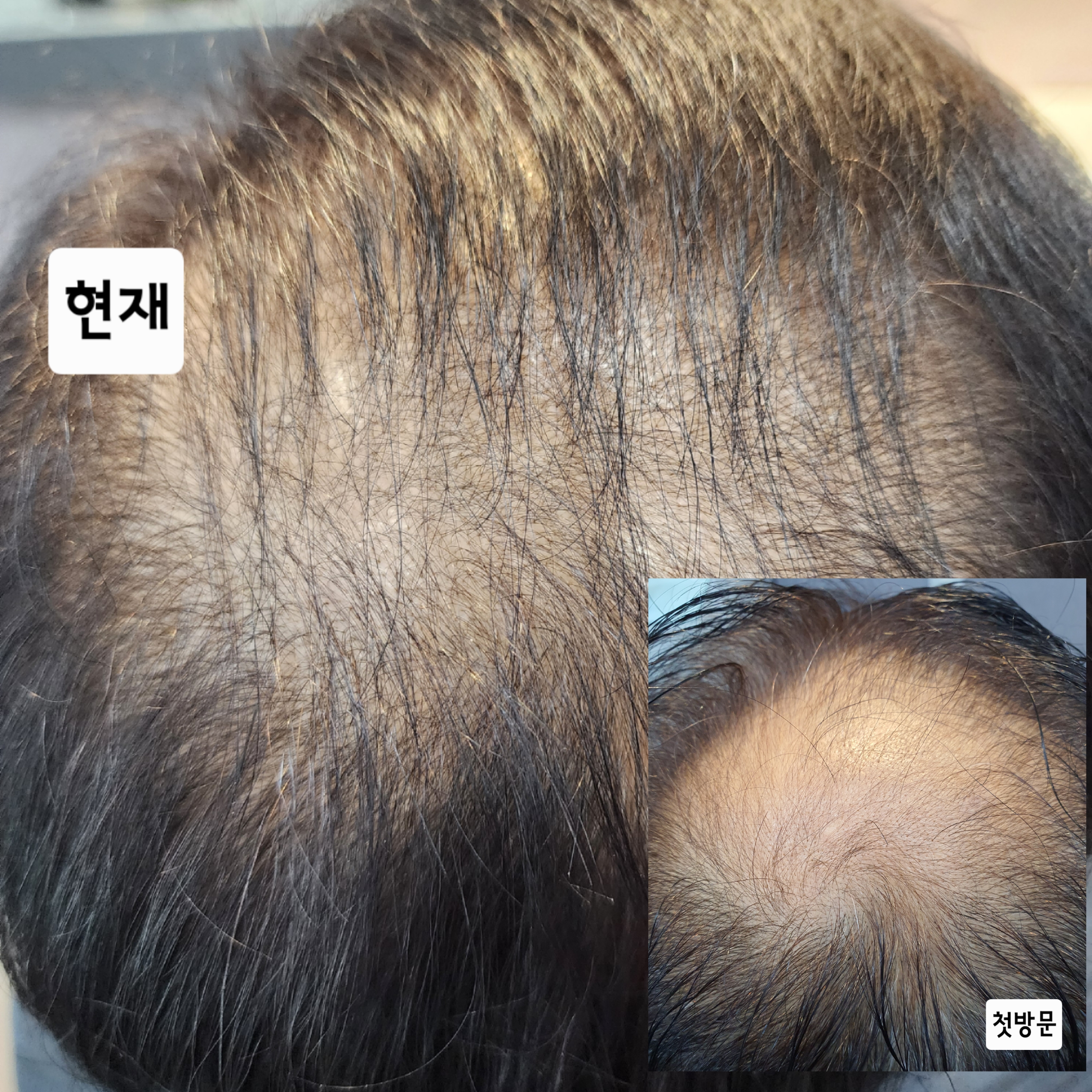 제이부띠 대표 이미지