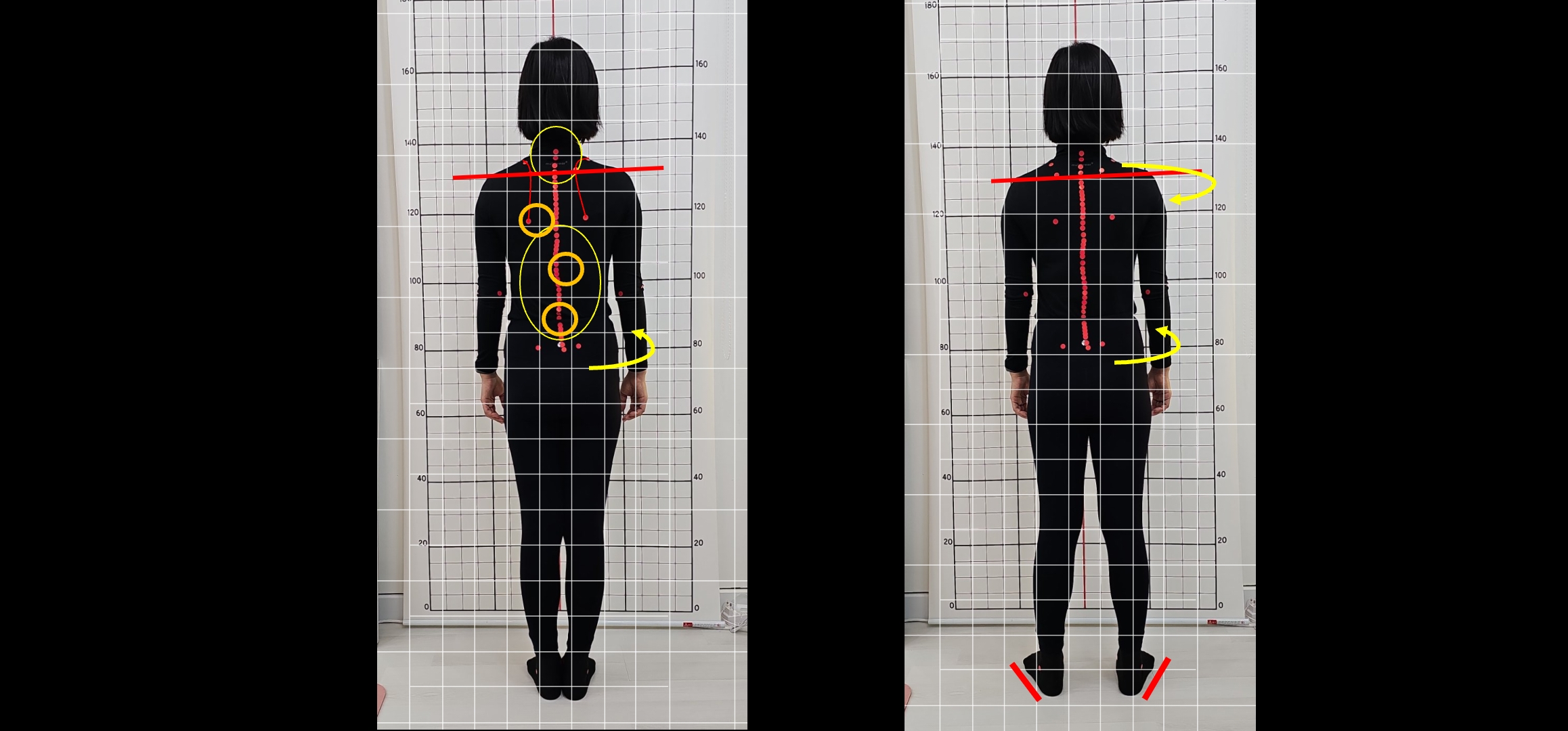 골드레인 필라테스 대표 이미지