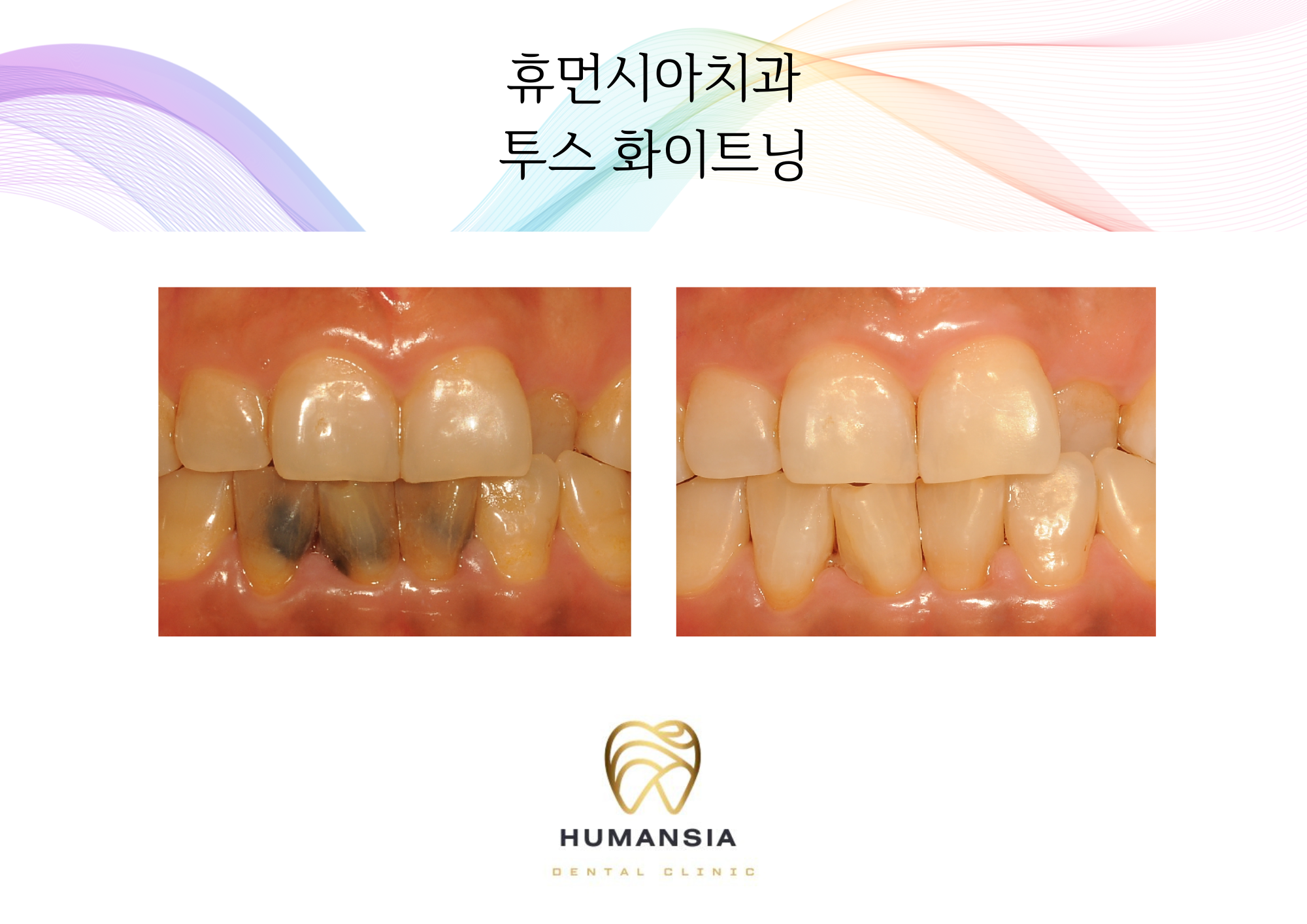휴먼시아치과의원 대표 이미지