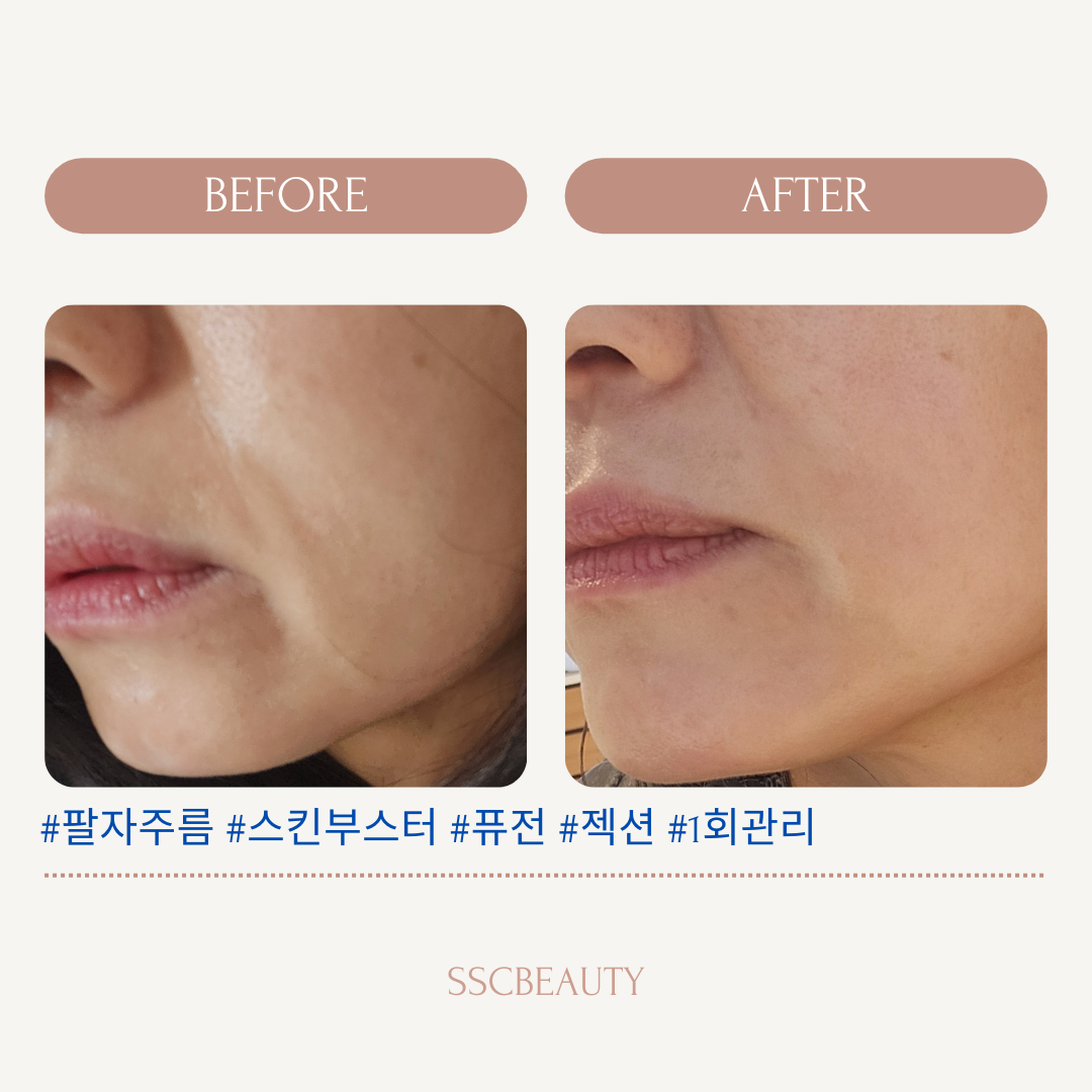 SSC 뷰티