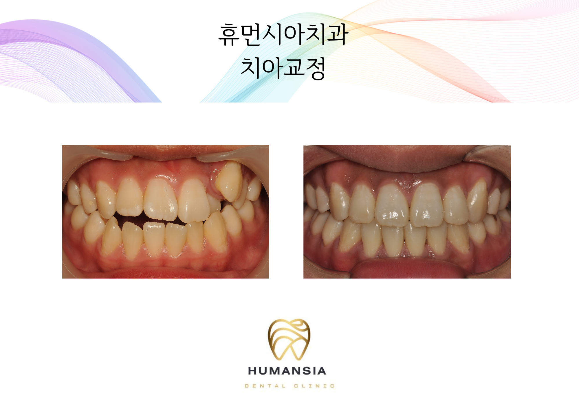 휴먼시아치과의원 대표 이미지