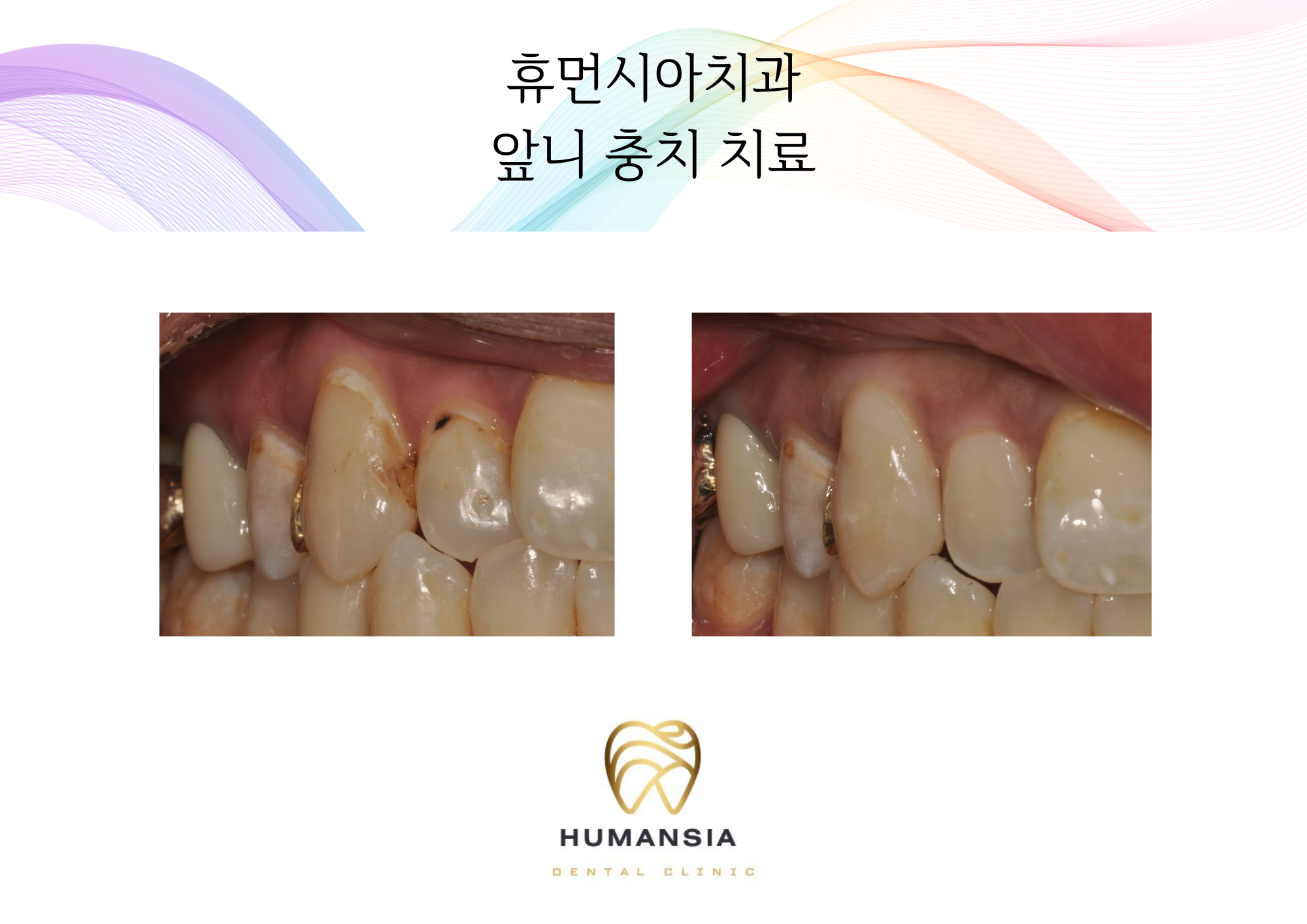 휴먼시아치과의원 대표 이미지