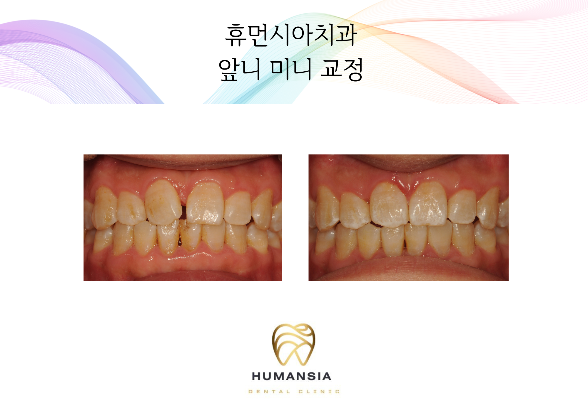 휴먼시아치과의원 대표 이미지