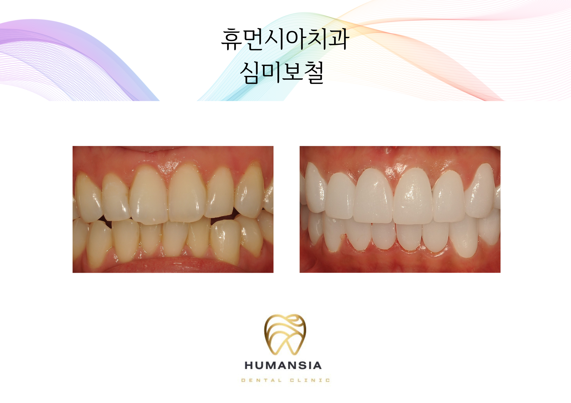 휴먼시아치과의원 대표 이미지