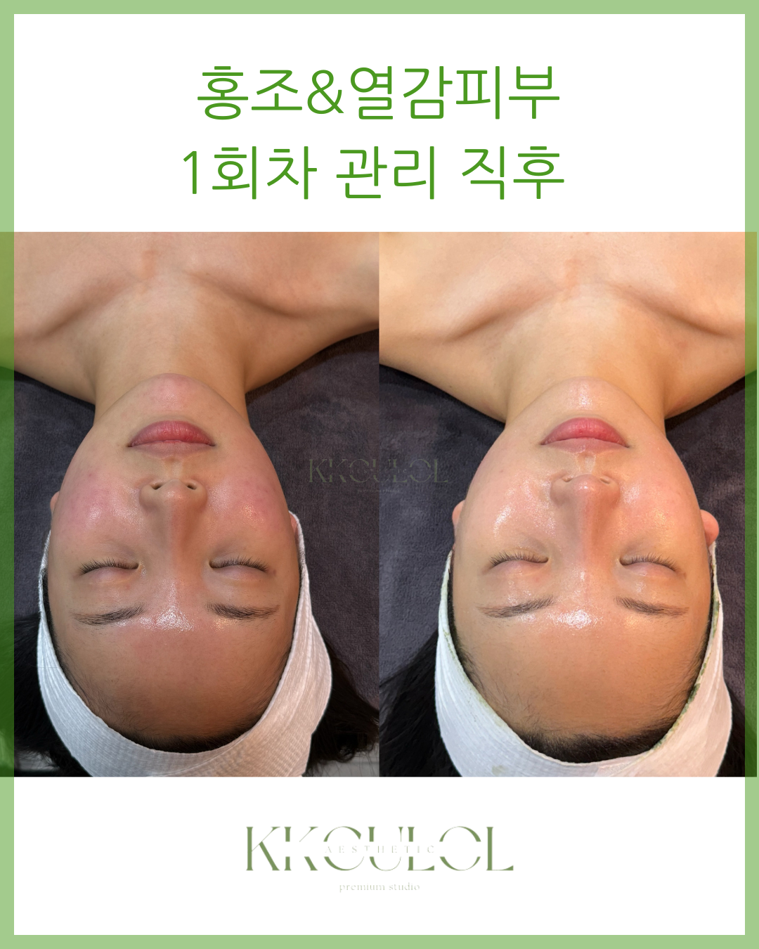 끌올에스테틱 월평점