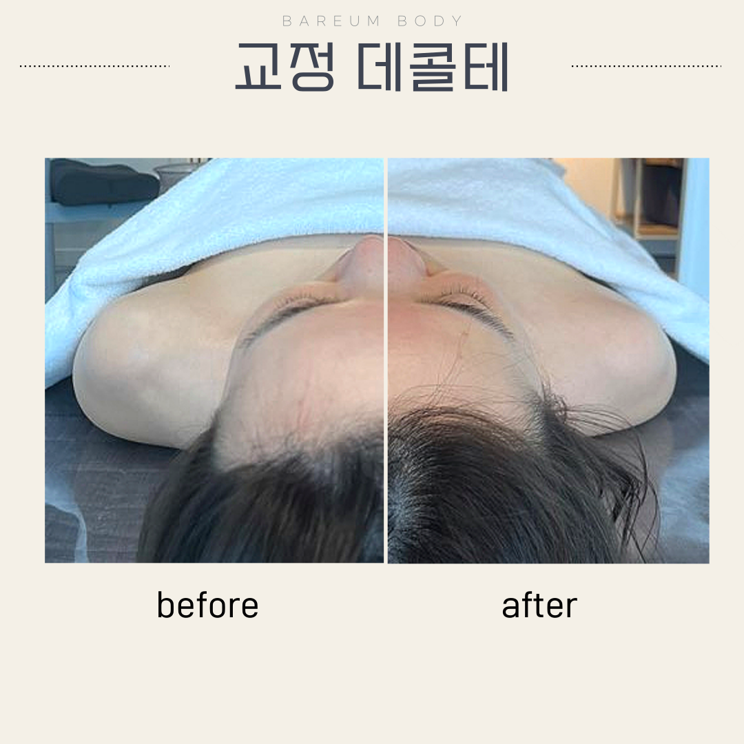 바름바디케어